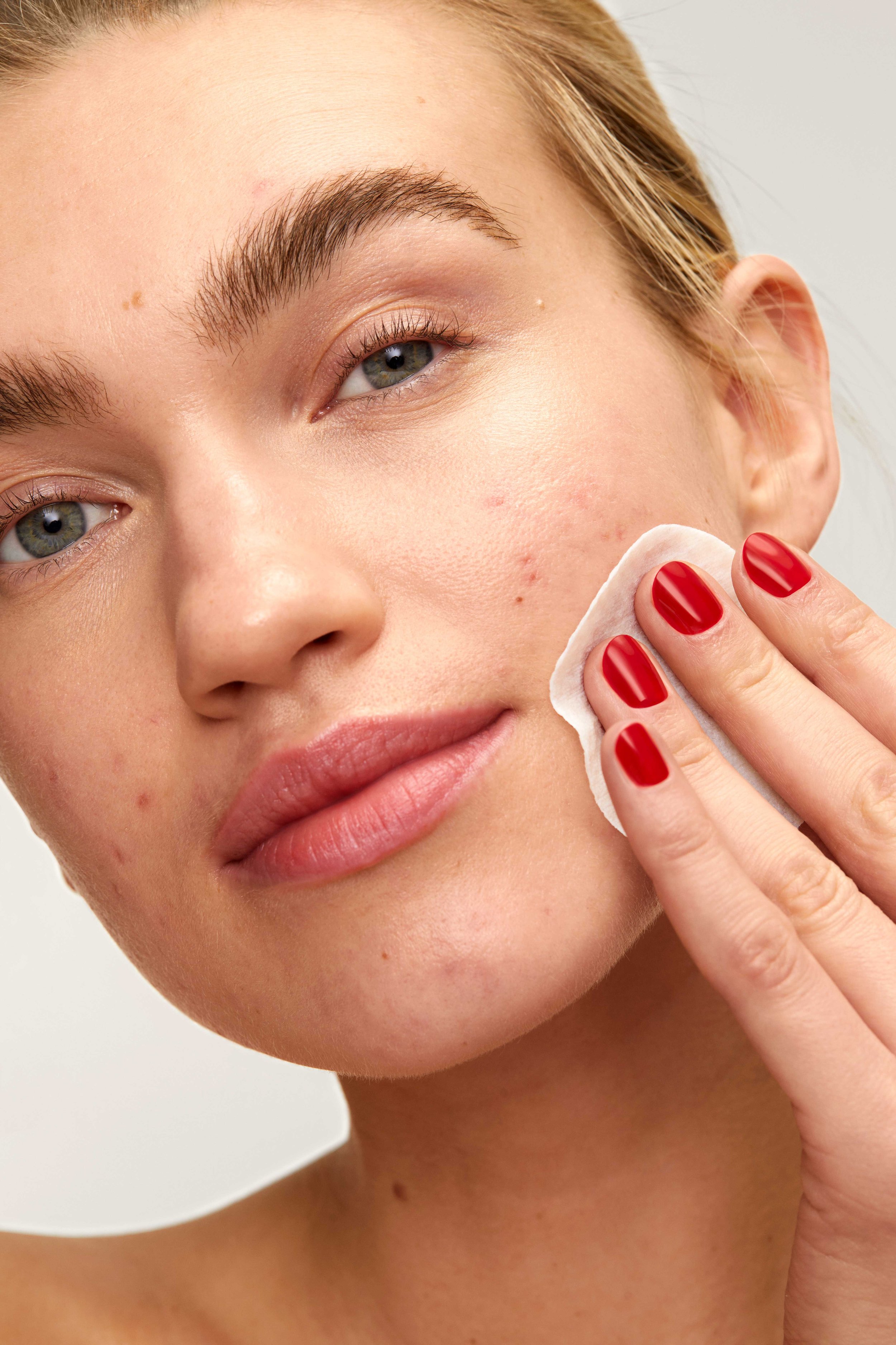 ACNE _PADS-Model_06.jpg
