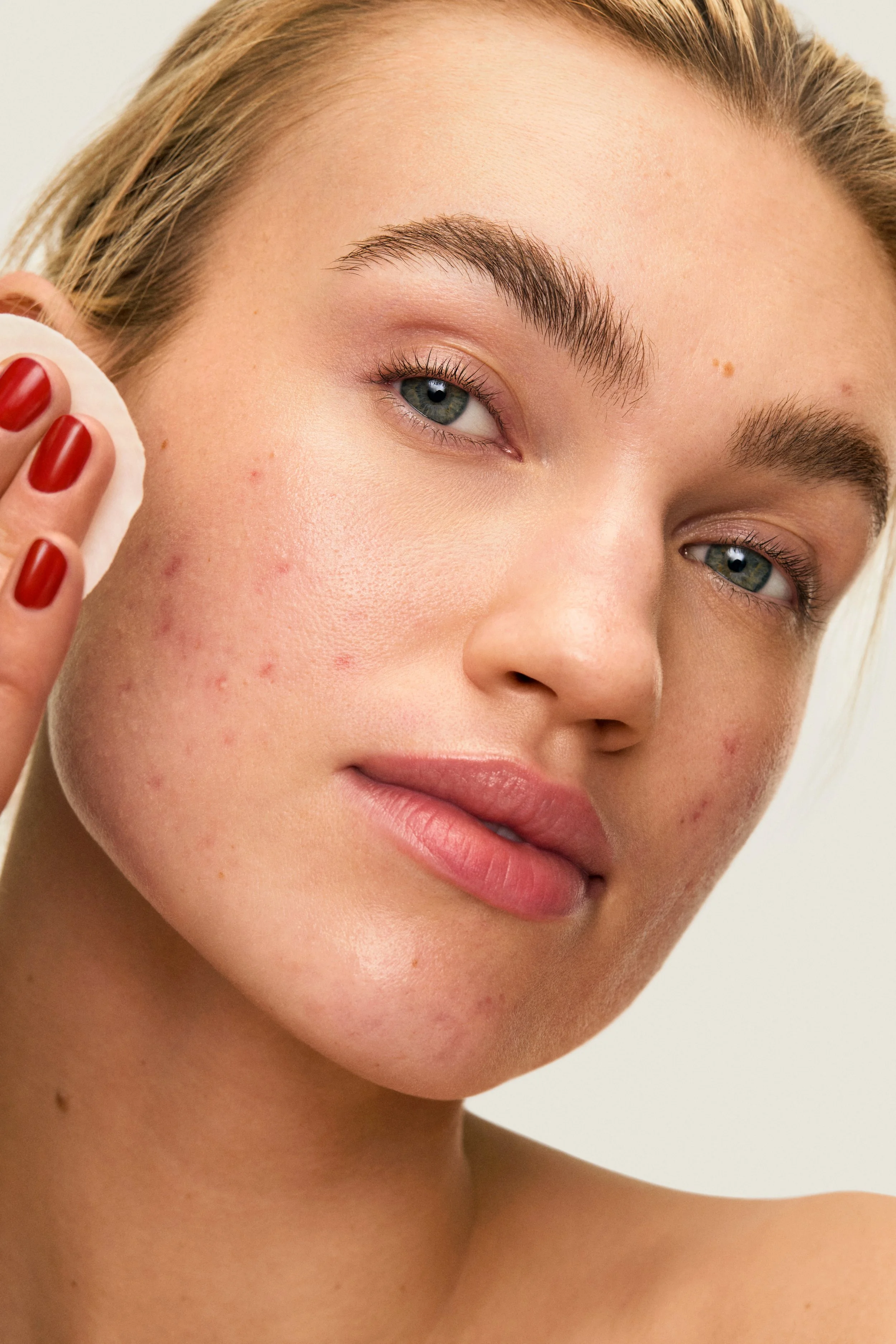 ACNE _PADS-Model_03.jpg