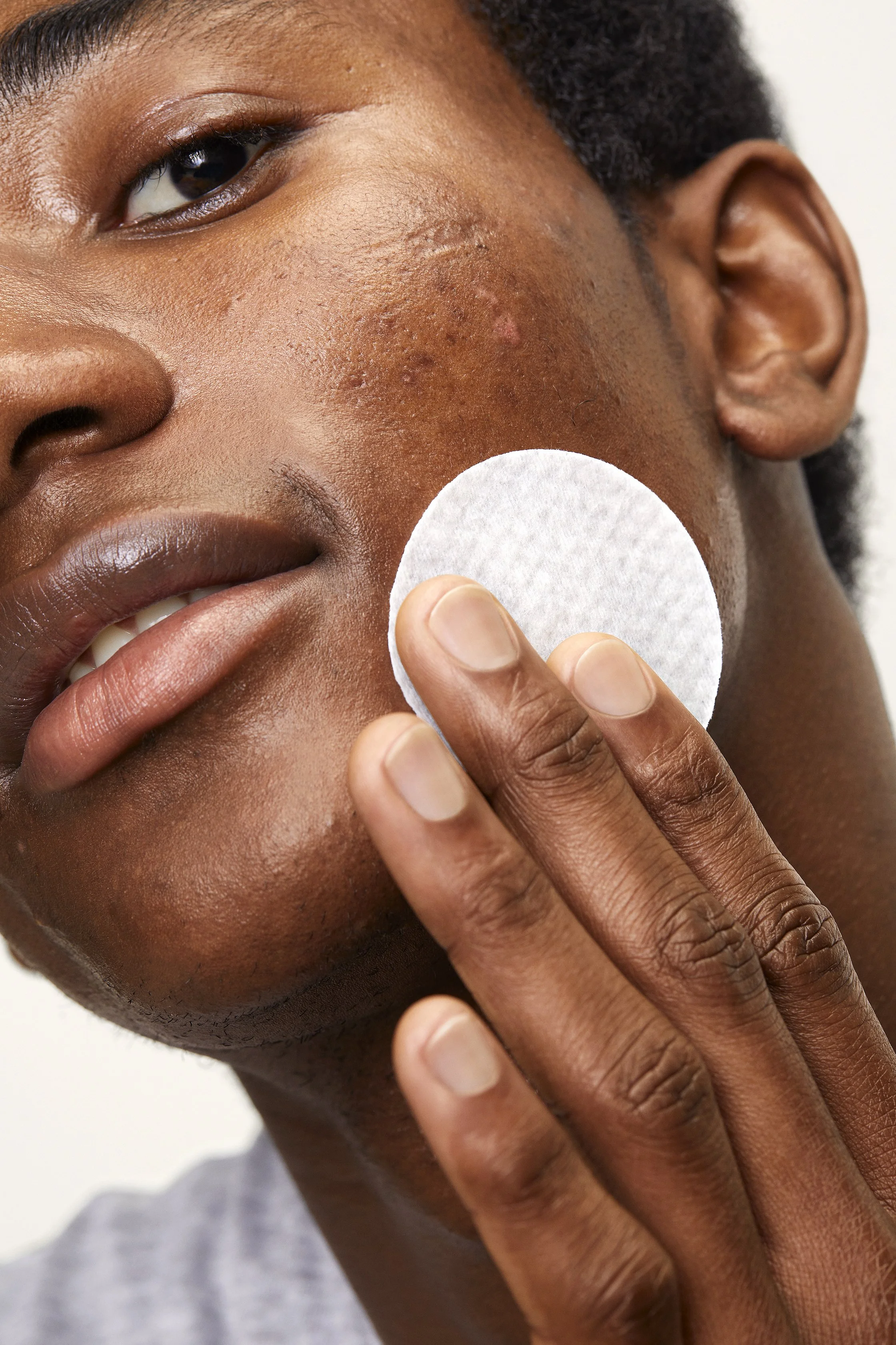 ACNE _PADS-Model_05.jpg