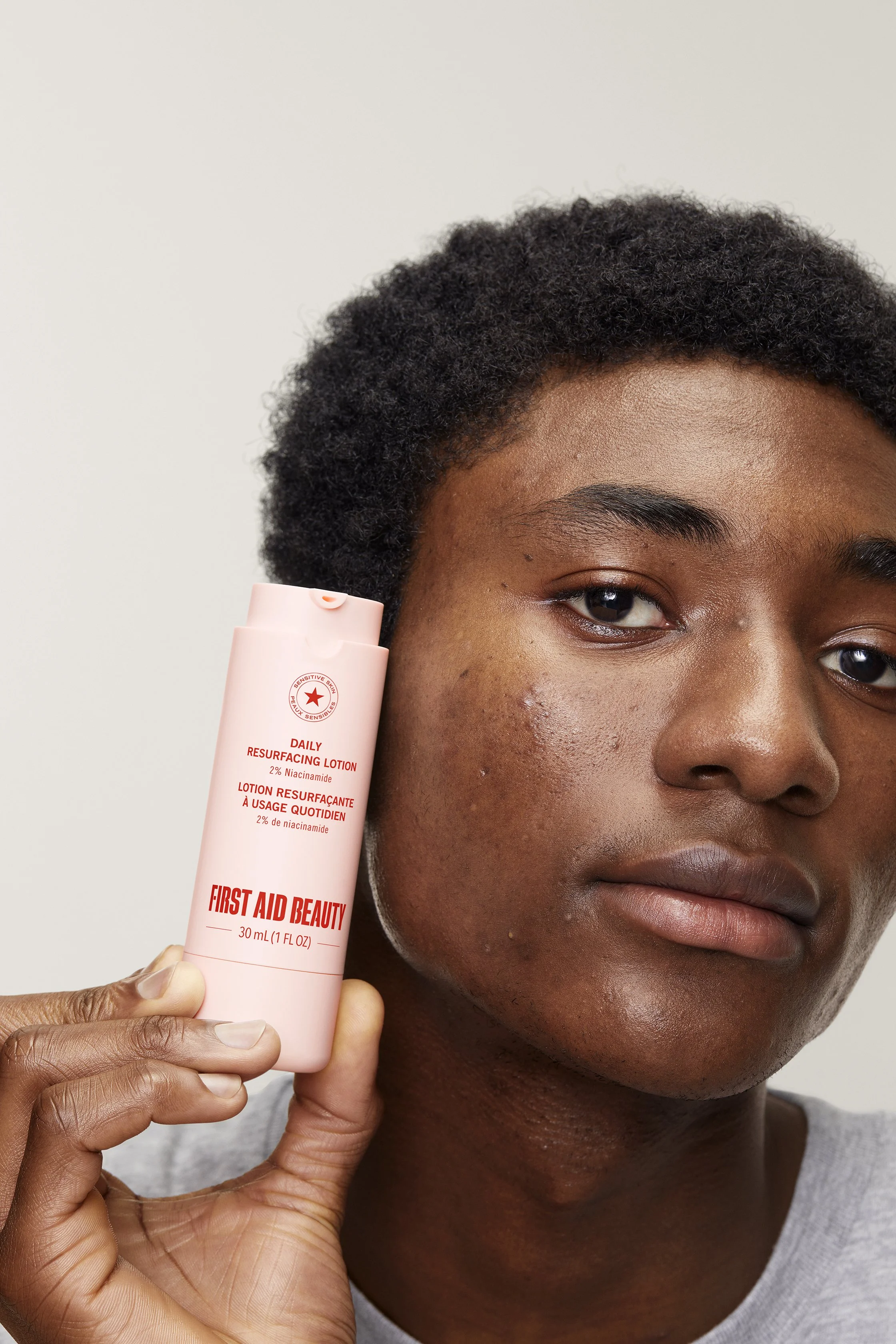 ACNE_LOTION-Model_01.jpg