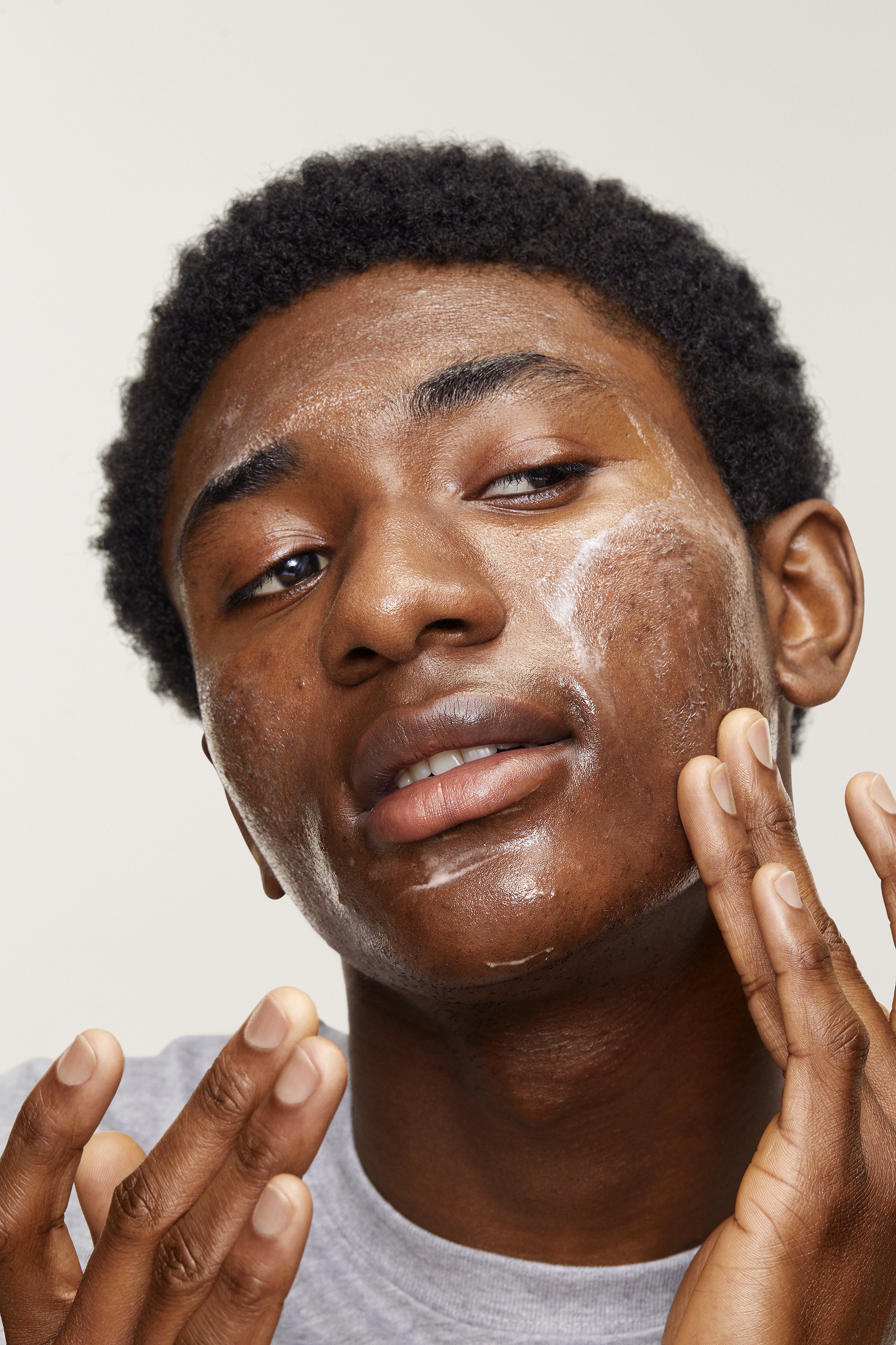 ACNE_LOTION-Model_03.jpg