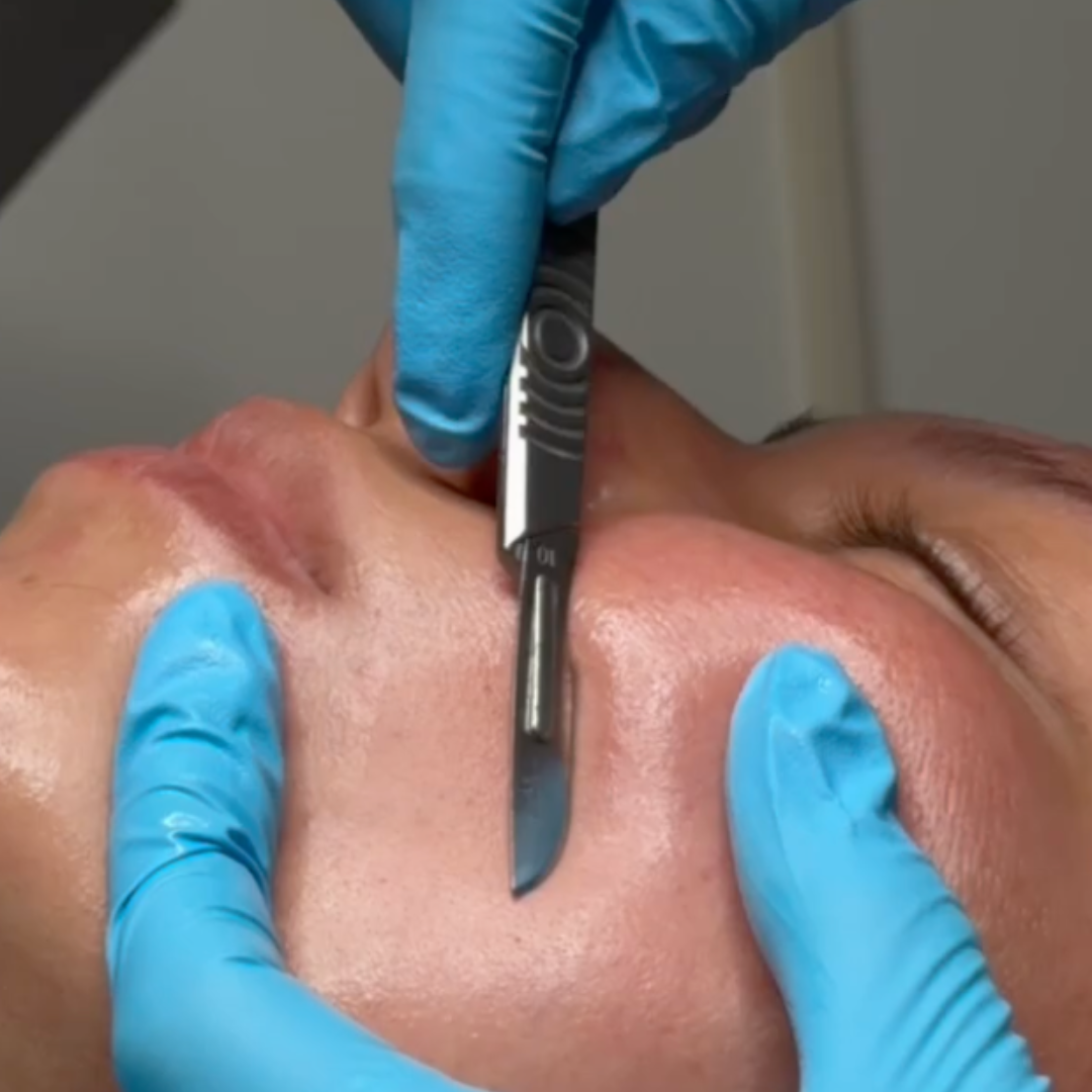 /dermaplaning-facial-lakeland-fl