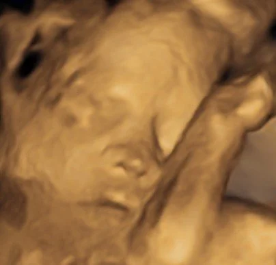 4D image of baby with arm by its face.