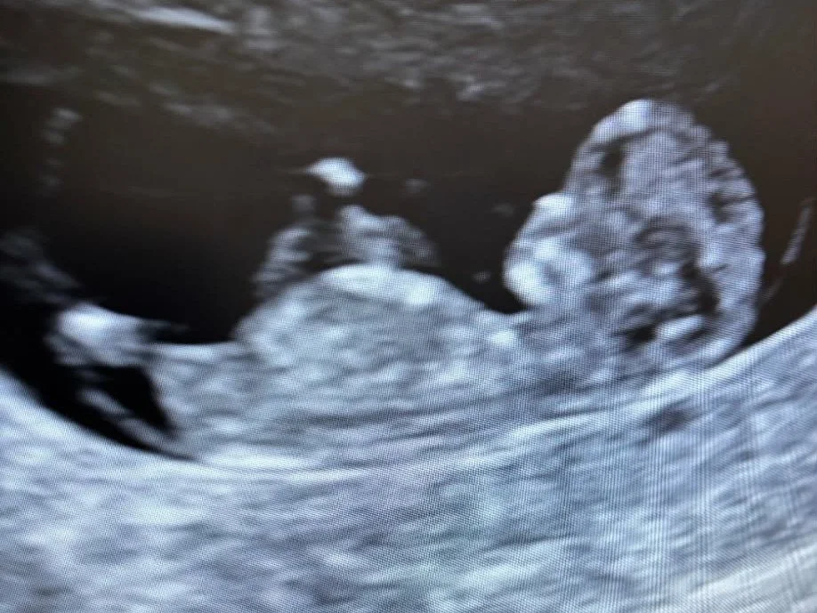 18wk ultrasound full body face side profile.
