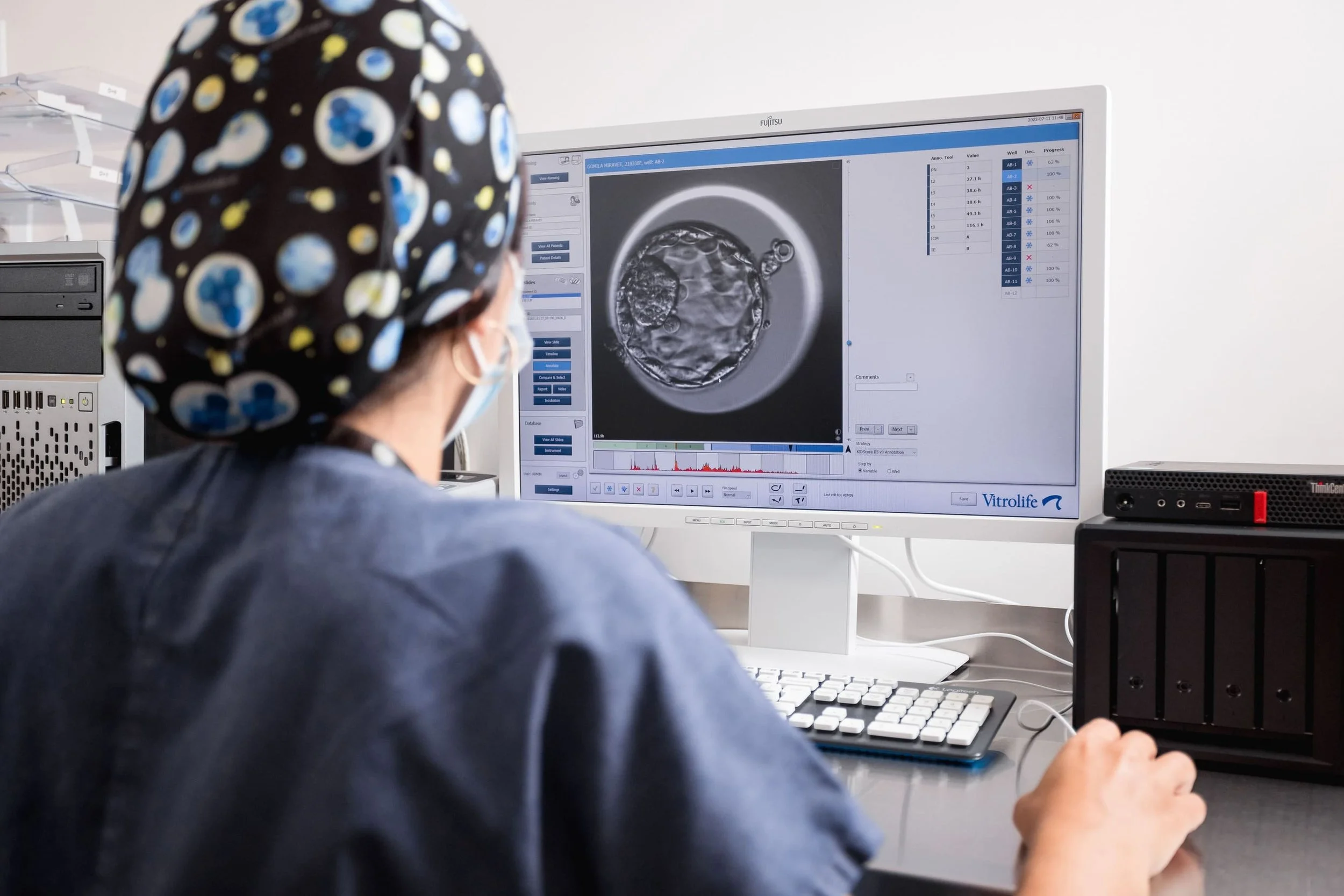 PGT-A: cos’è la diagnosi genetica preimpianto e quando si usa
