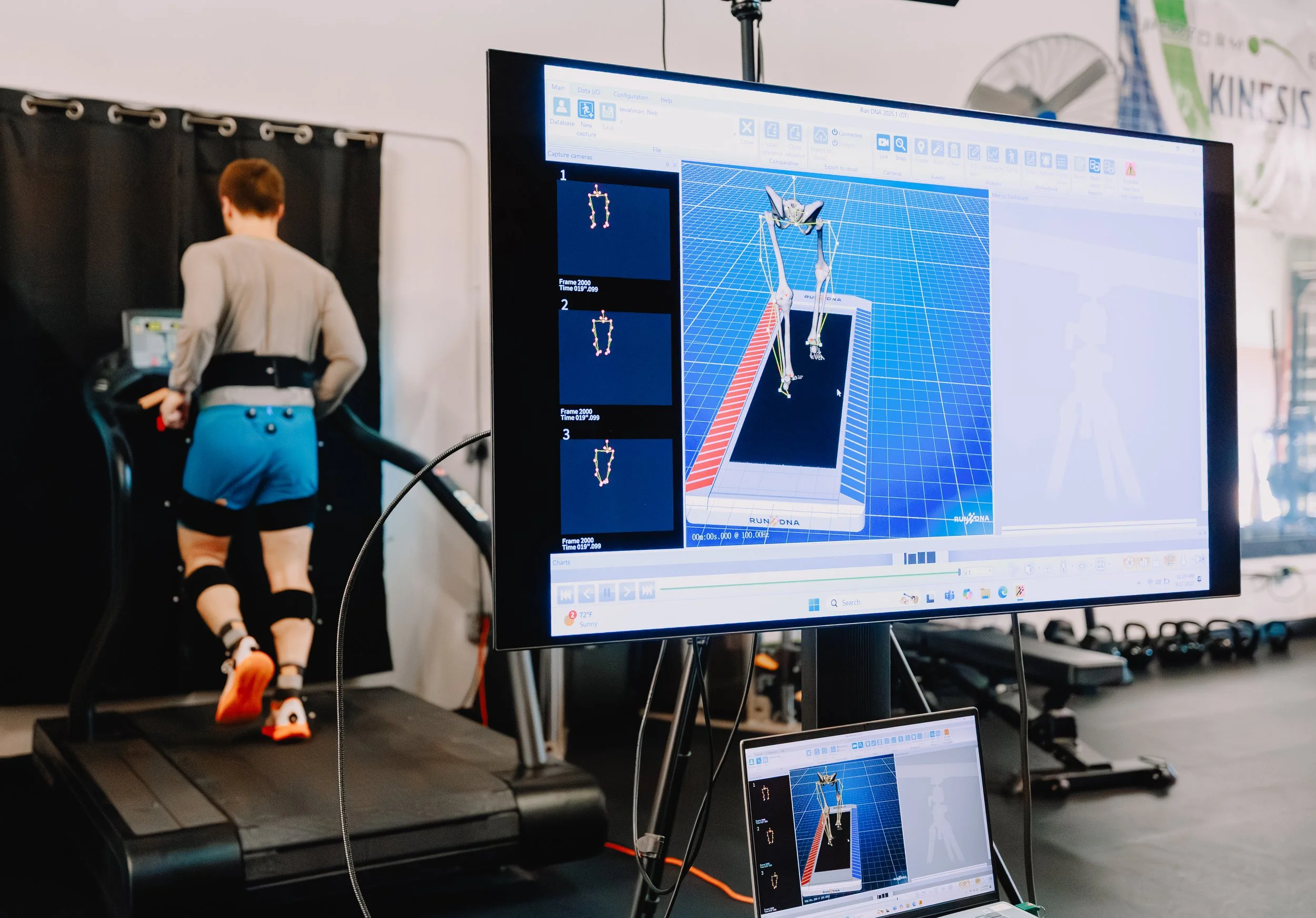 Walking Gait Analysis