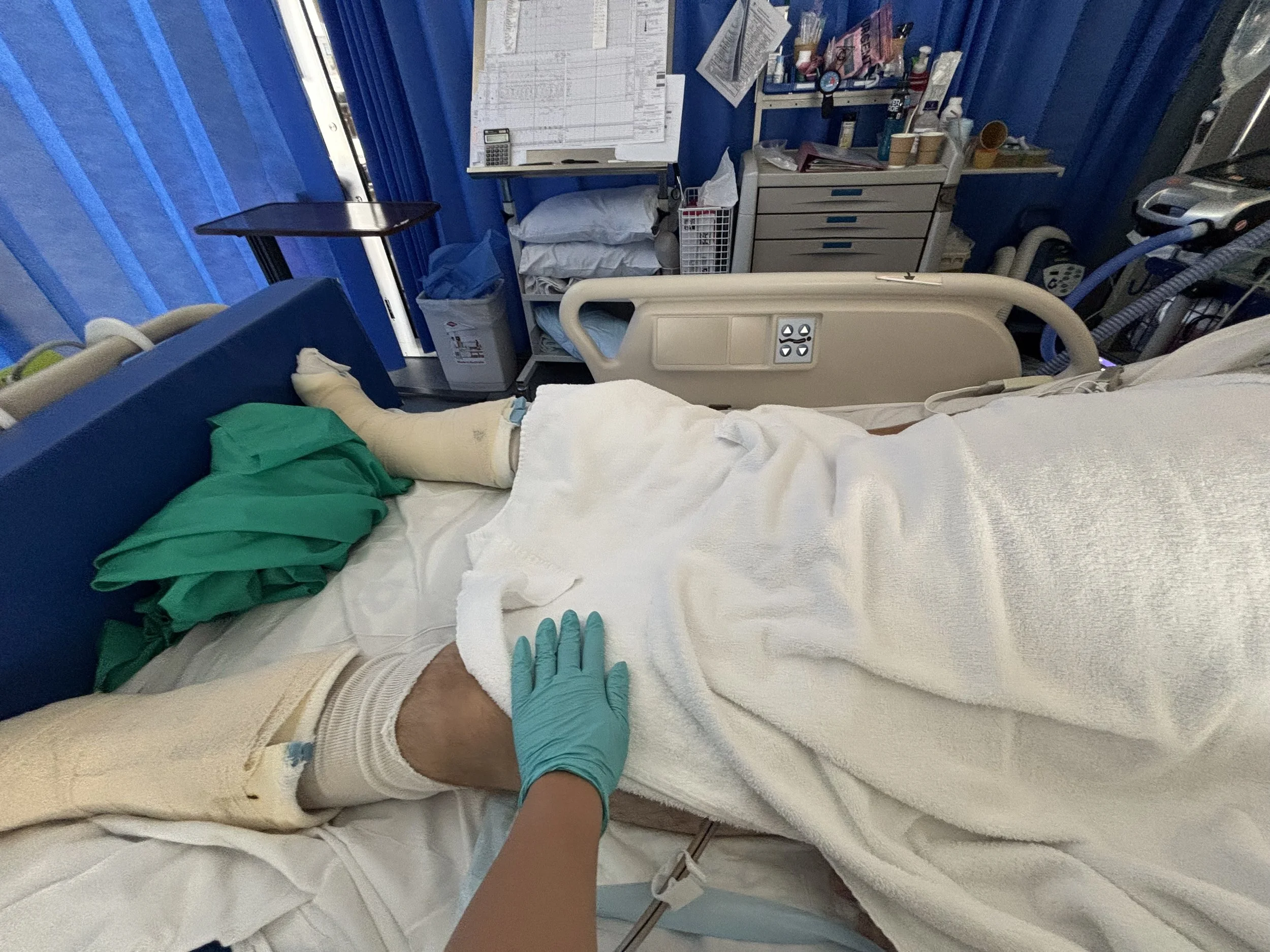 A person lying in a hospital bed with a green hospital gown, wearing a hospital wristband, and a gloved hand resting on their leg. Medical equipment, supplies, and blue curtains are visible in the background.