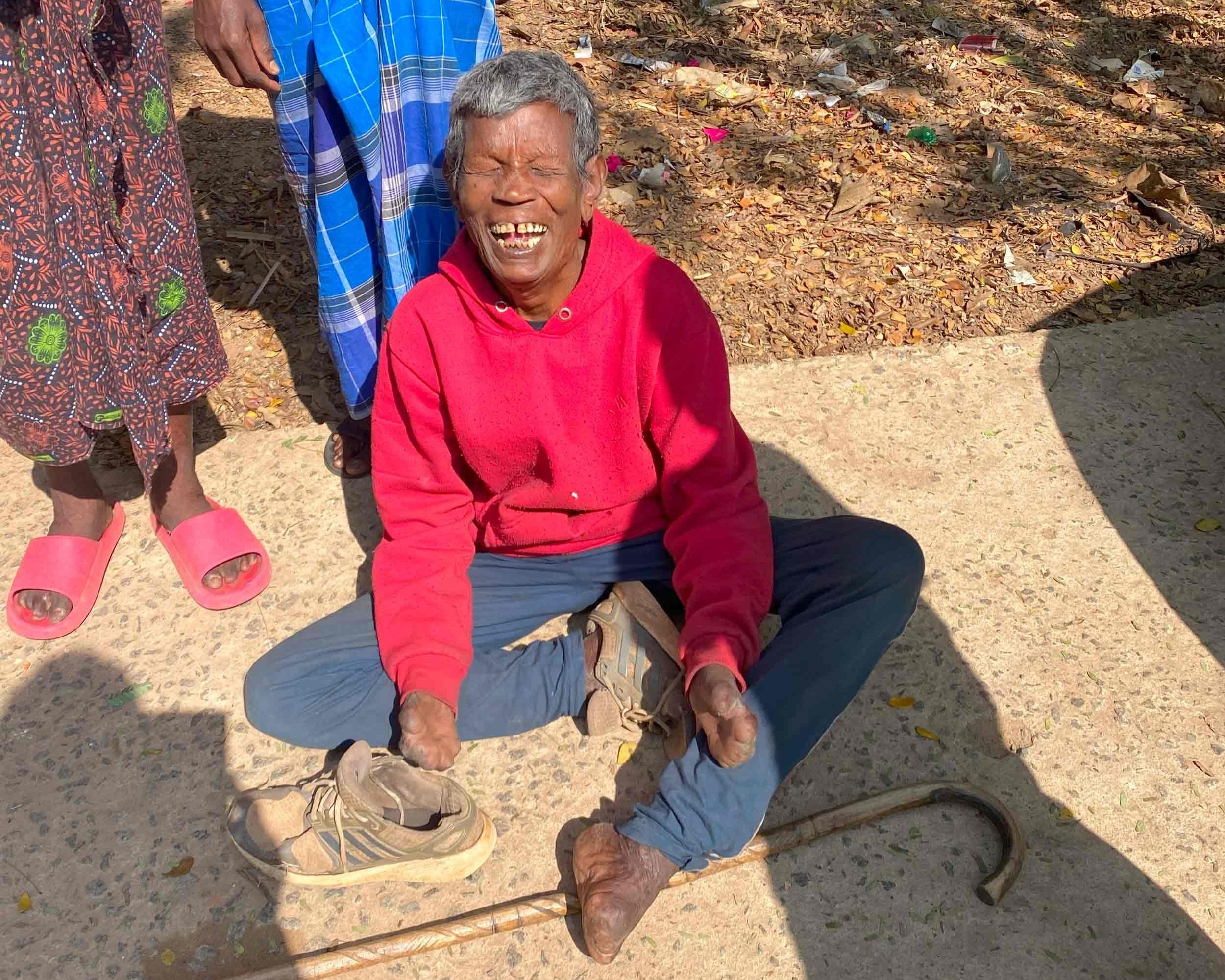 Leprosy: A Hidden Humanitarian Crisis