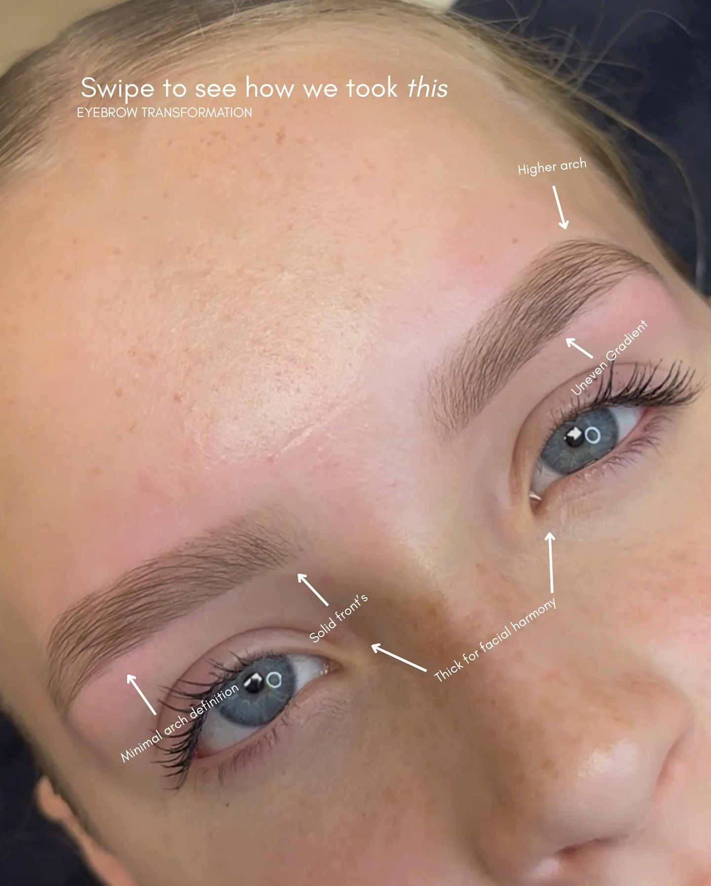Swipe to see the transformation &rarr;

Effortless beauty starts with the right brows. Book your session today. 

&bull;
&bull;

&bull;
&bull;

#EyebrowTransformation #BrowPerfection #BeautyTherapy #RefinedBeauty #SubtleTransformation #FlawlessBrows 