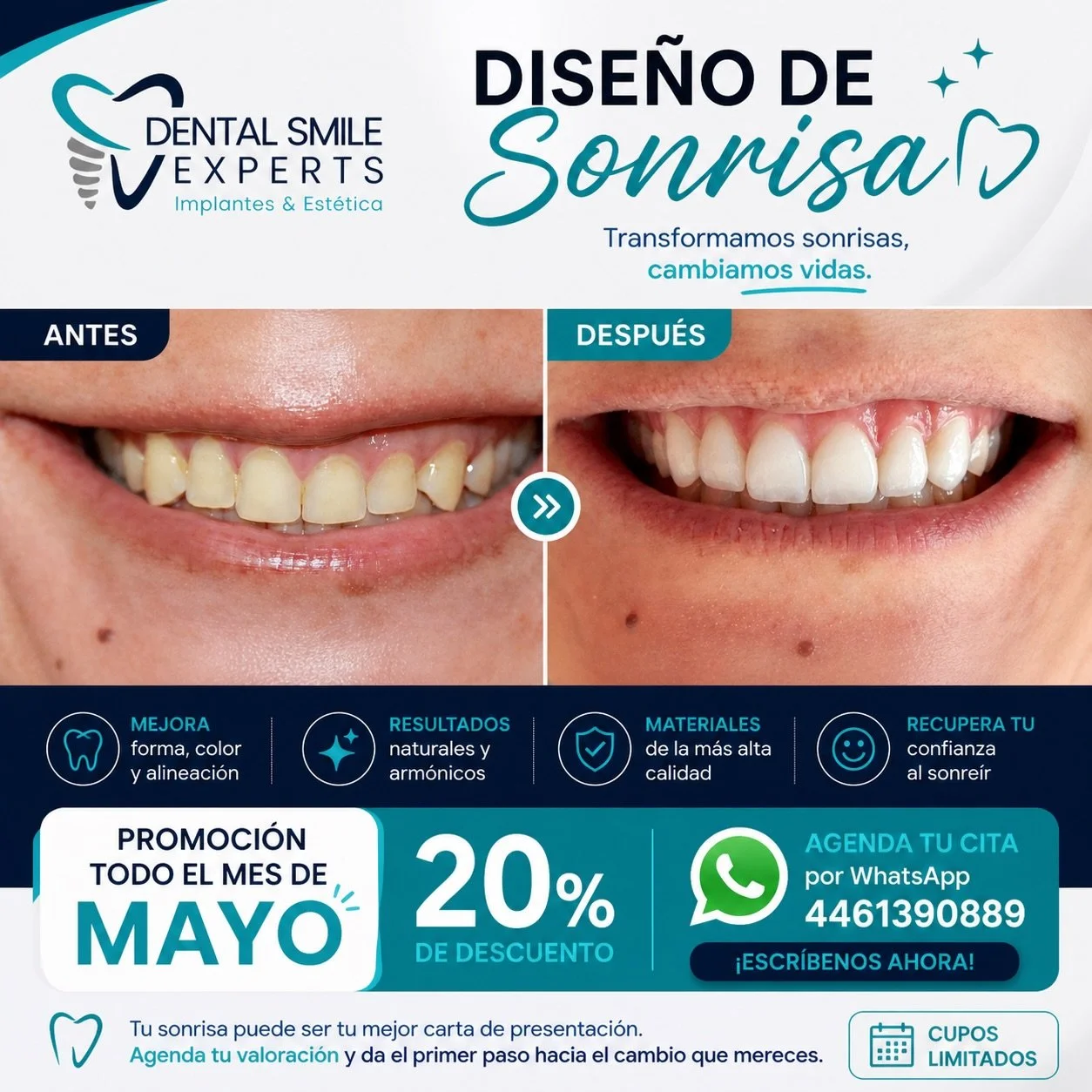 ✨ &iexcl;Transforma tu sonrisa en d&iacute;as, no en meses! ✨ 

&iquest;Te gustar&iacute;a tener una sonrisa perfecta, blanca y alineada sin dolor ni largos tratamientos? 😁 

💎 Especialistas en Dise&ntilde;o de Sonrisa 
💎 Resultados naturales y pe
