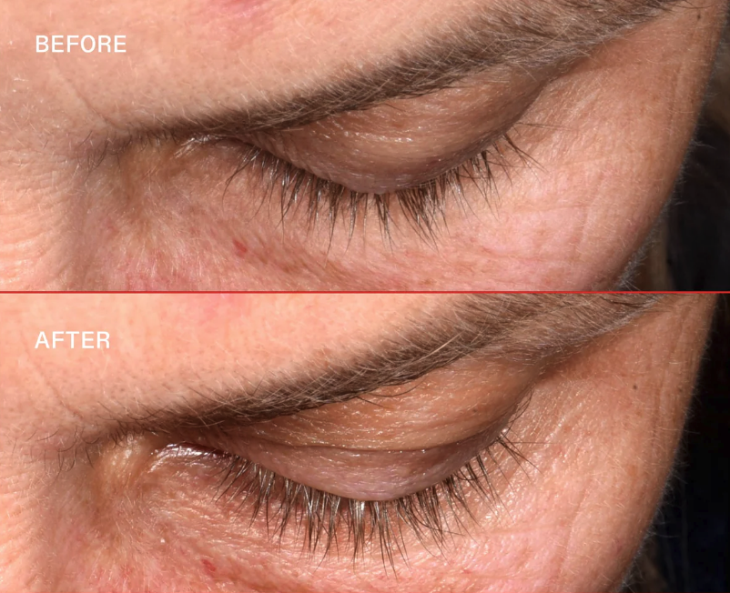 Screenshot 2026-03-19 at 11.41.37 PM.png (⁠コピ⁠ー⁠)