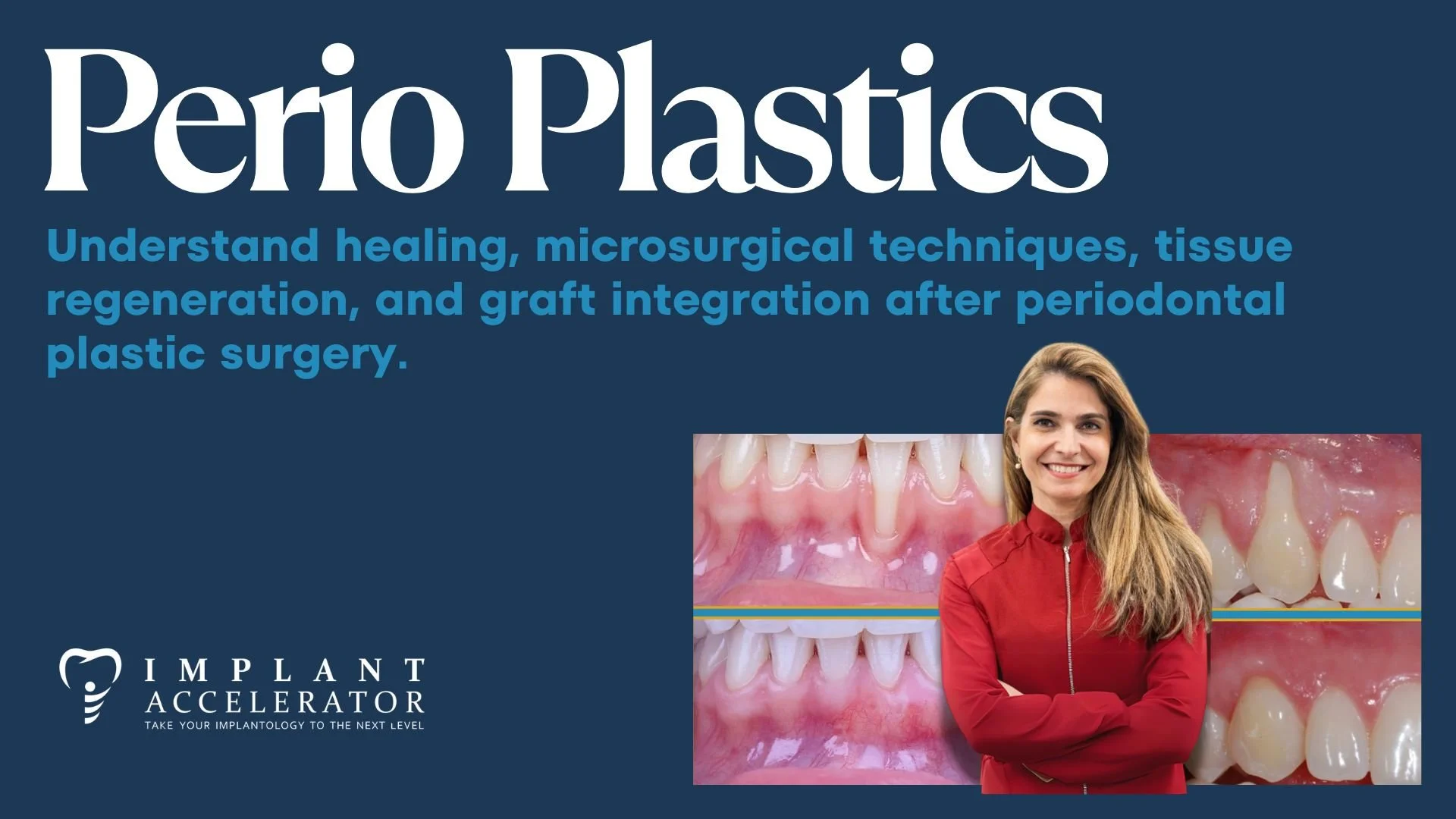 Perio Plastics Master Class Dental Course