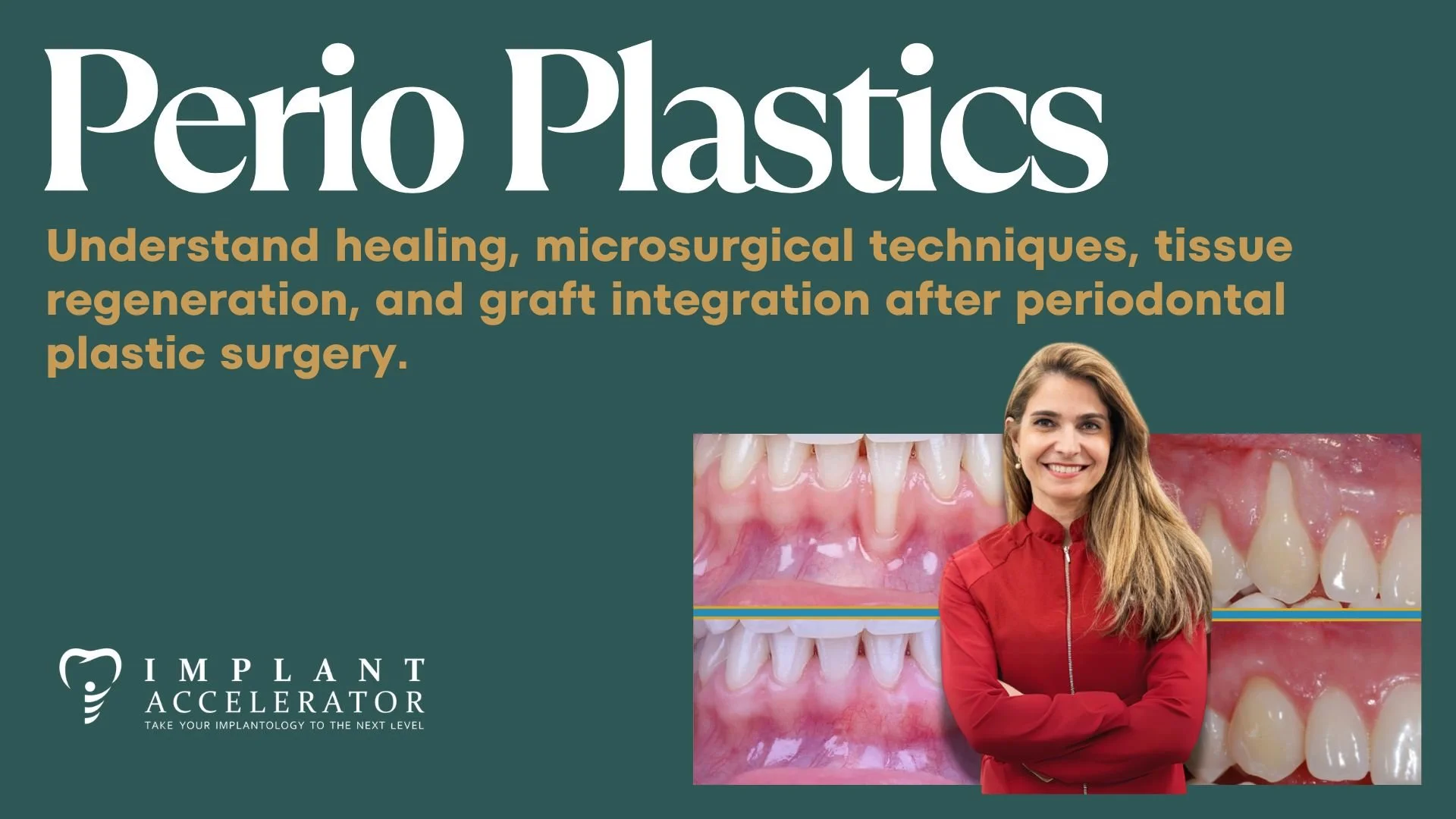 Perio Plastics Master Class Dental Course