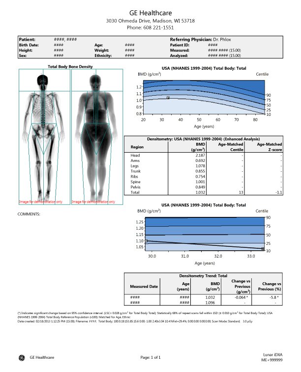 DEXA Body Composition Scan in Pittsburgh, PA — Precision Metrics Lab