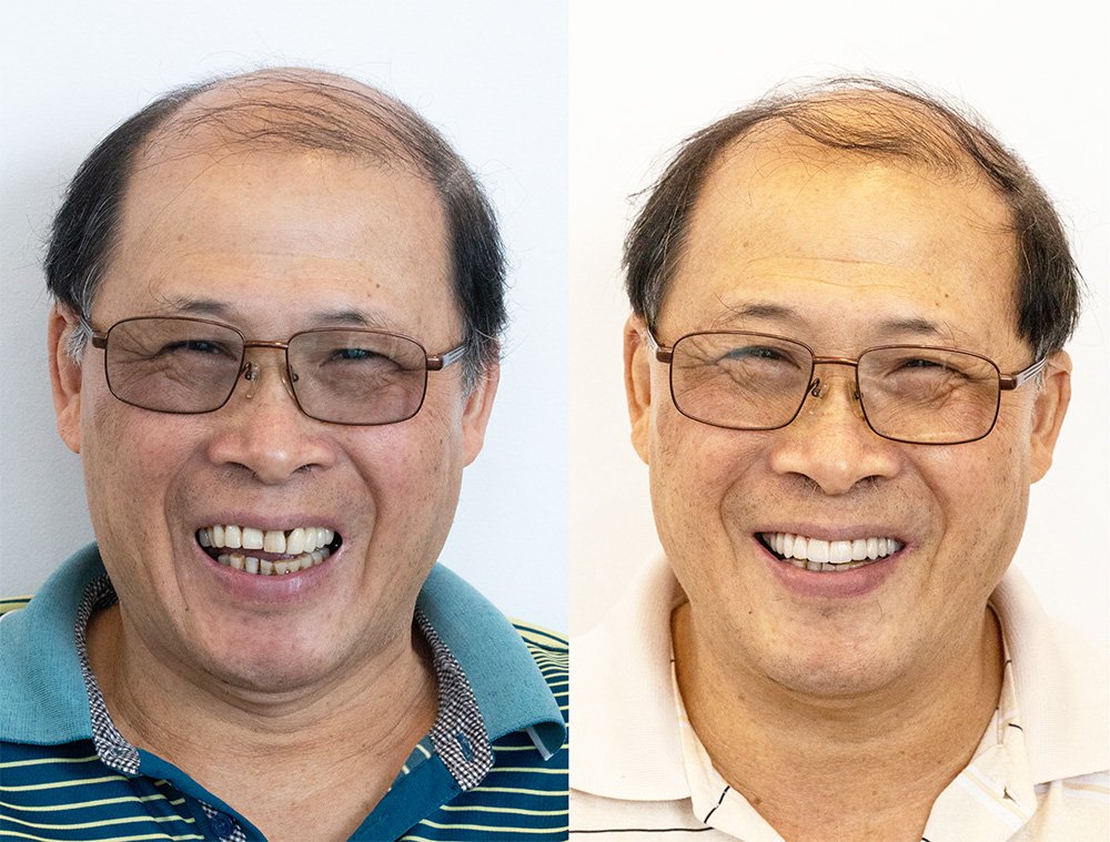 Two side-by-side images of the same middle-aged man wearing glasses and smiling. The left image shows him in a striped shirt, the right in a white polo shirt.
