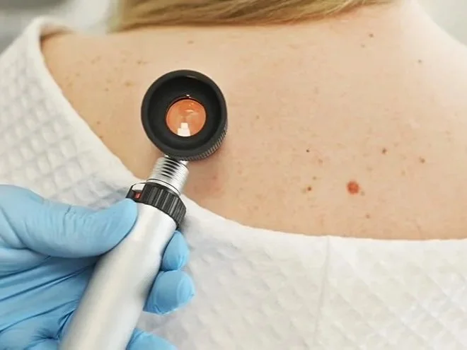 A healthcare professional wearing blue gloves is examining a person's back using a medical otoscope.