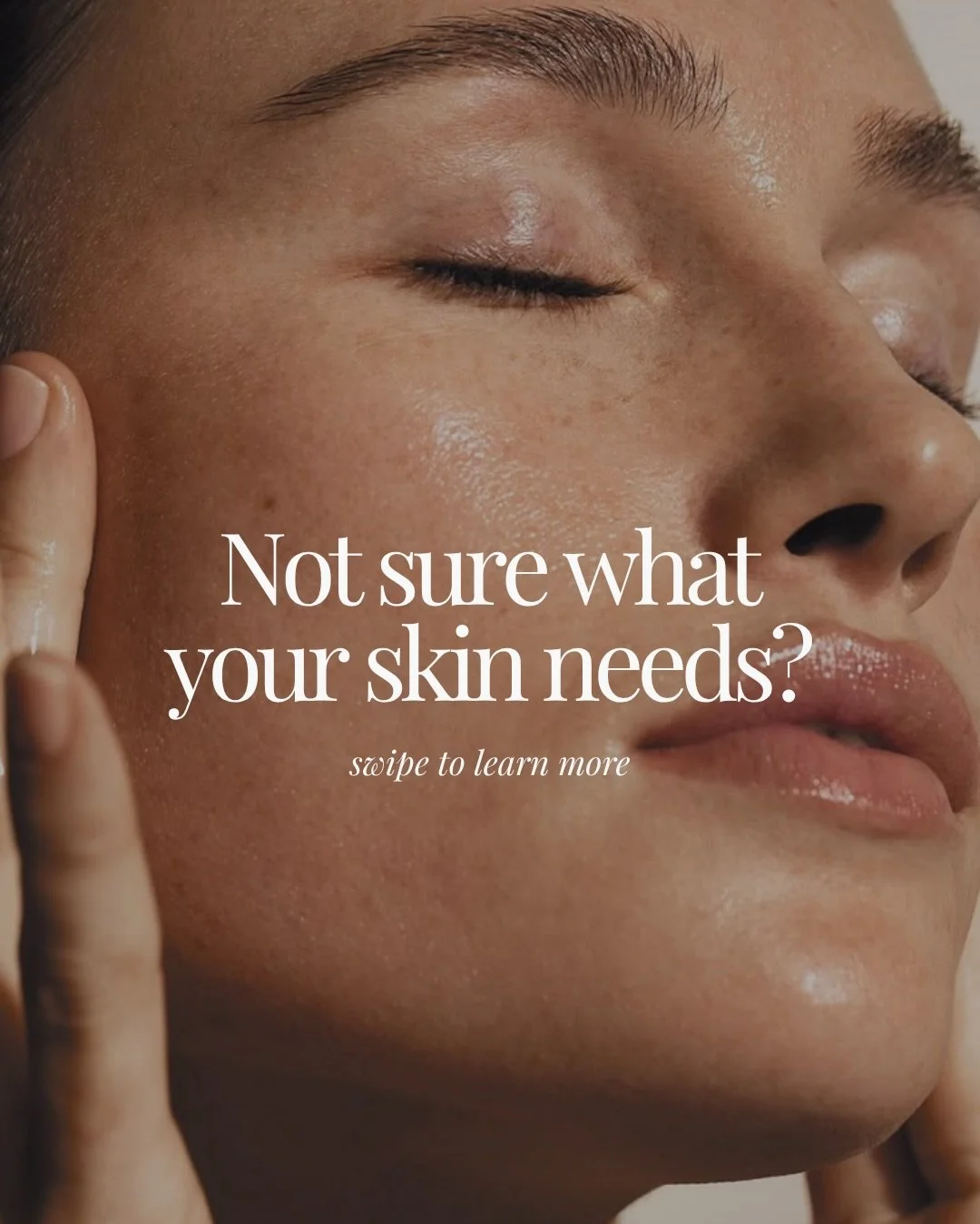 Each product has a purpose:

✨ Nourishing Serum for lightweight hydration
🤍 Rich Serum for deep moisture support
🌿 Restore Cream to seal it all in

It&rsquo;s not about using more,it&rsquo;s about using what your skin actually needs.