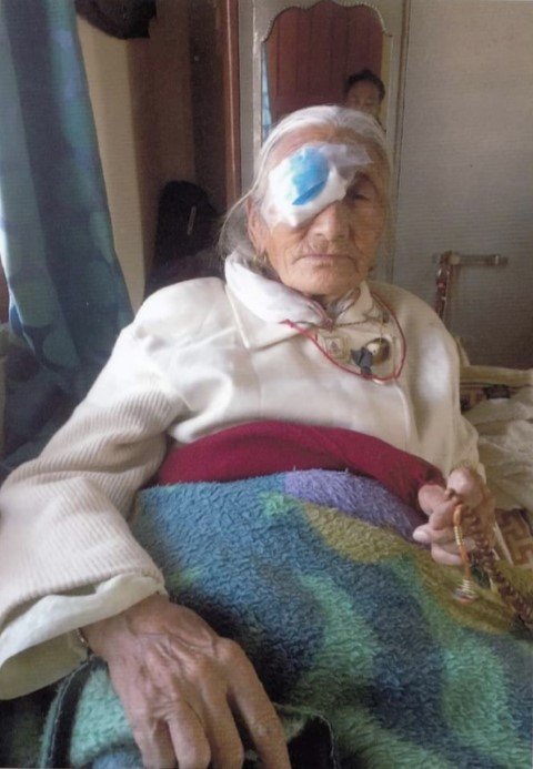 Free-Cataract-Surgery-Recipients-Picture-2-Small.jpg
