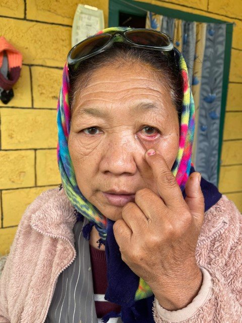 Free-Cataract-Surgery-Recipients-Picture-31-Small.jpg