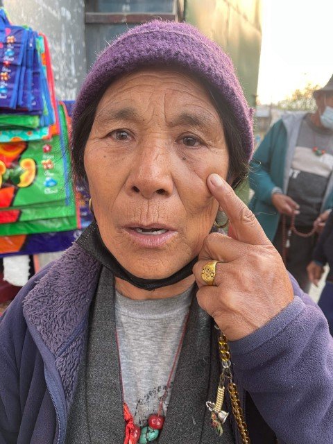 Free-Cataract-Surgery-Recipients-Picture-32-Small.jpg