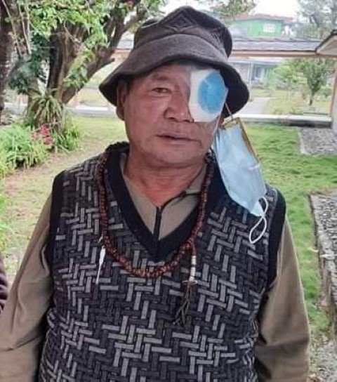 Free-Cataract-Surgery-Recipients-Picture-5-Small.jpg