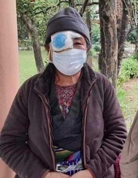 Free-Cataract-Surgery-Recipients-Picture-6-Small.jpg