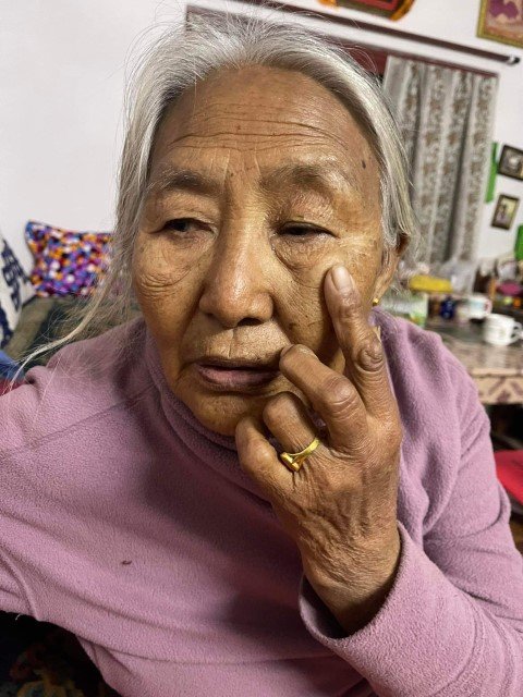 Free-Cataract-Surgery-Recipients-Picture-7-Small.jpg