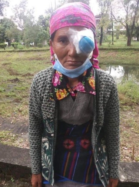 Free-Cataract-Surgery-Recipients-Picture-4-Small.jpg
