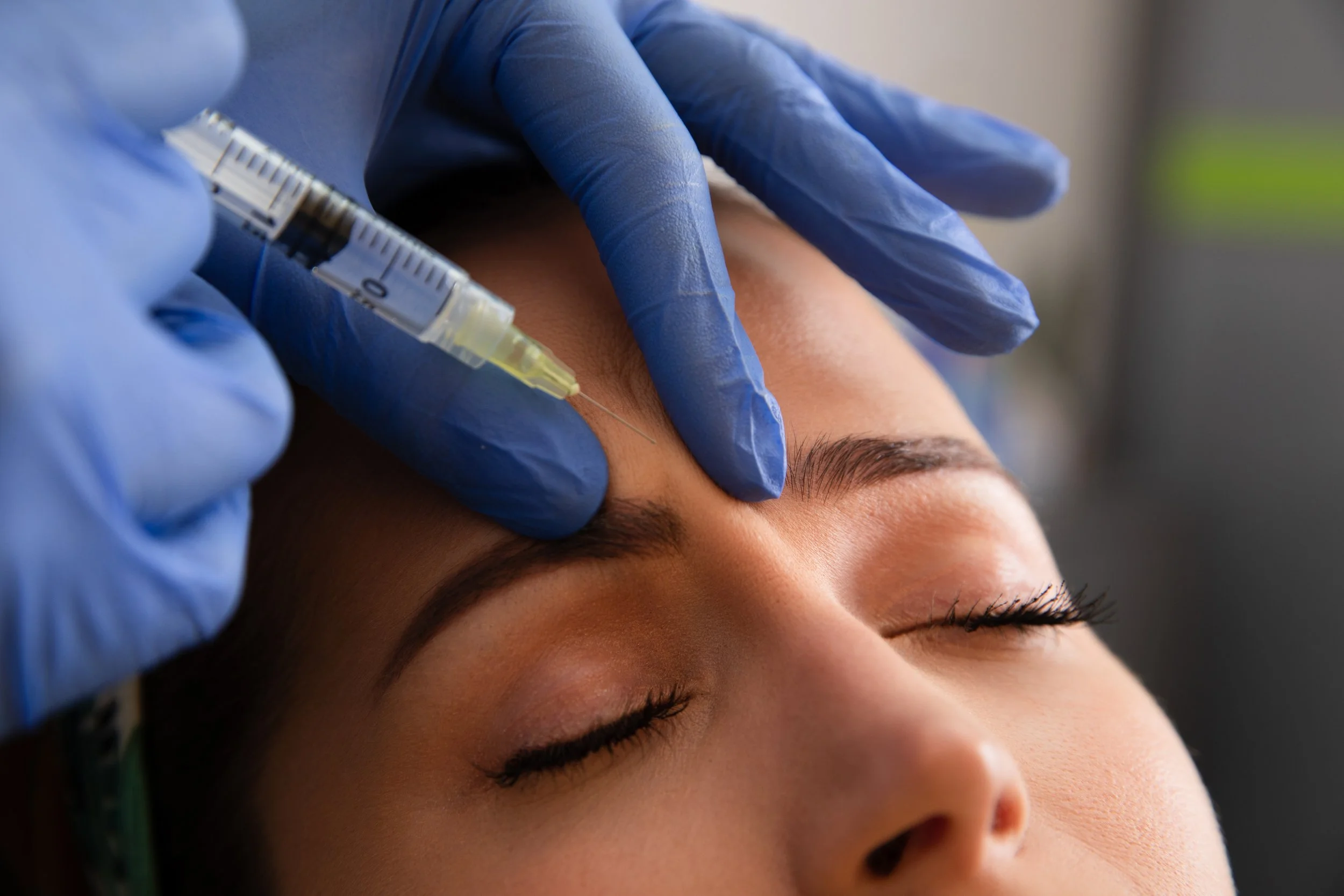 Close-up of a person receiving a cosmetic injection in the forehead by a professional wearing blue gloves.