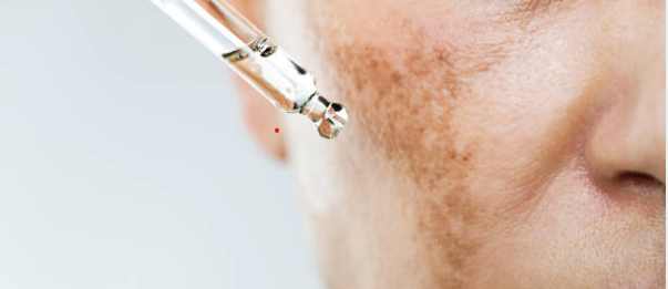 Injections