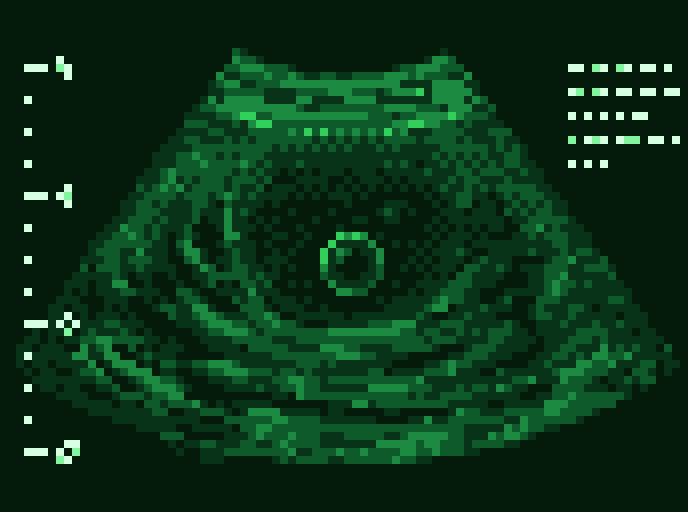 Pixel art 8-bit animation of a sonogram showing a humanoid frog developing in a womb