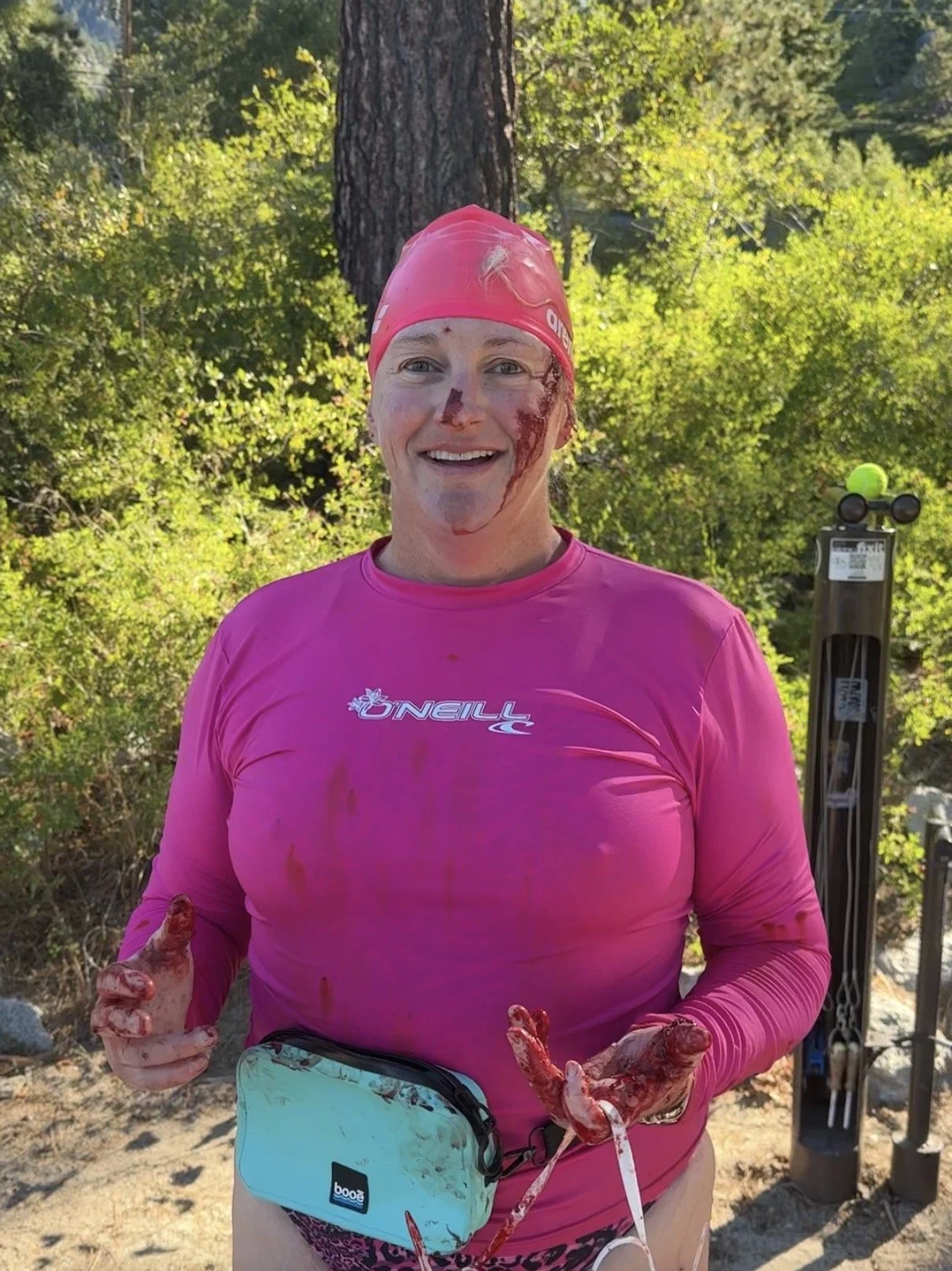 Lake Tahoe Otter Attack: What It Taught Me About Being Prepared for the Unexpected