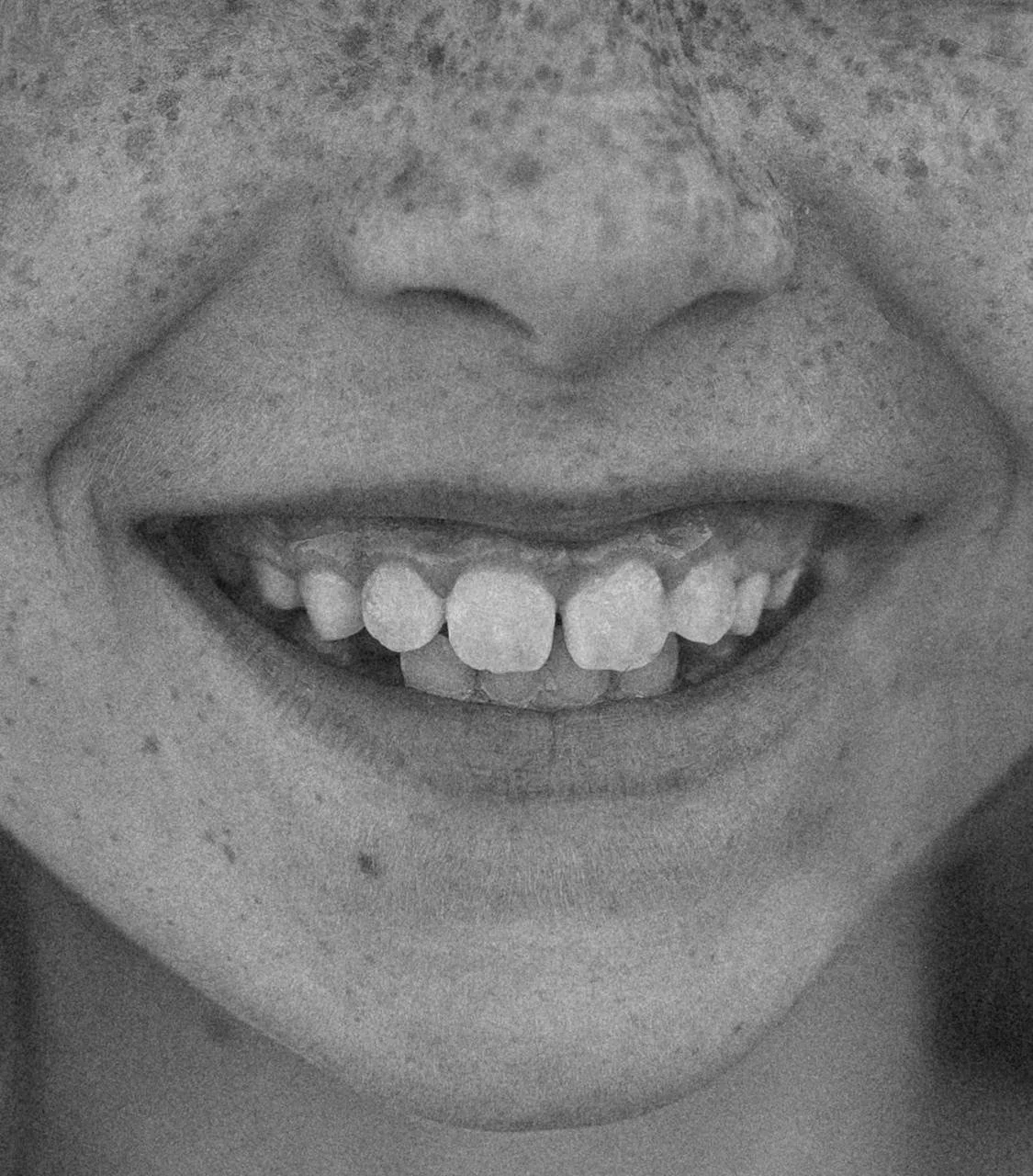 Teeth.jpg