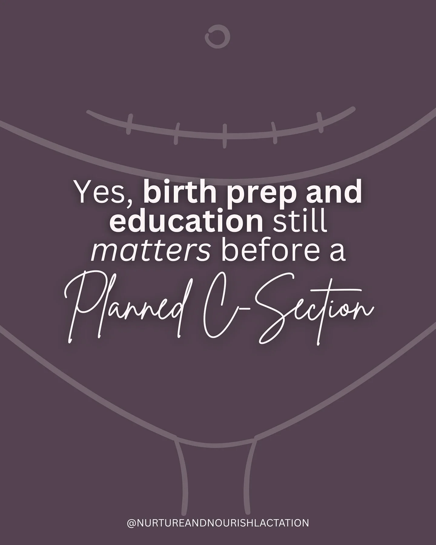 There&rsquo;s a big misconception out there that you don&rsquo;t need to do much to prepare for a C-Section&hellip;

That it&rsquo;s something that happens TO you.

That you don&rsquo;t really have much in the way of options around personalisation.

