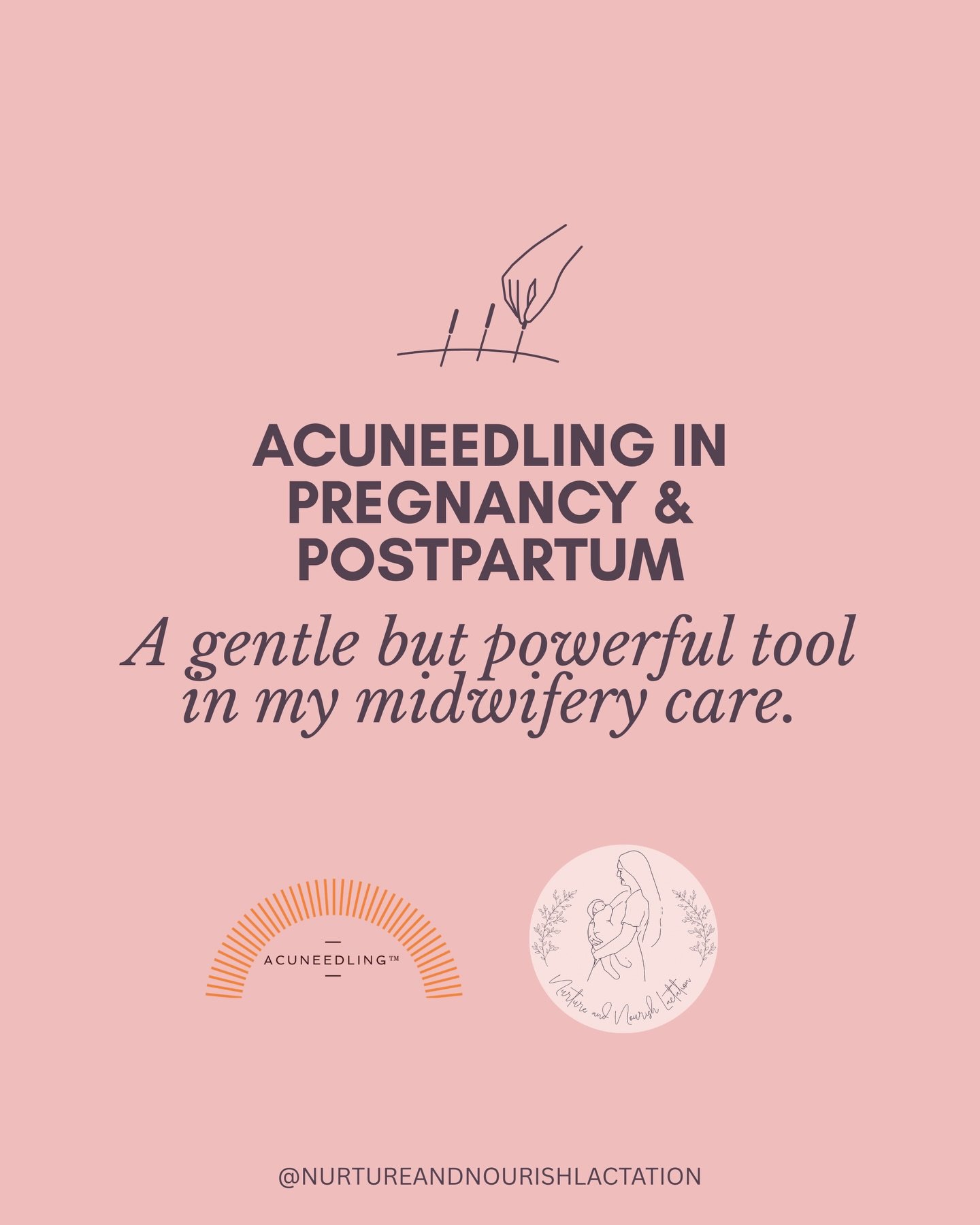 Have you heard of acuneedling?

I&rsquo;m incredibly passionate about this gentle evidence-based therapy and the huge benefits it can provide to pregnant mamas.

As an Endorsed Midwife, I have extensive medical training and a clear understanding of w