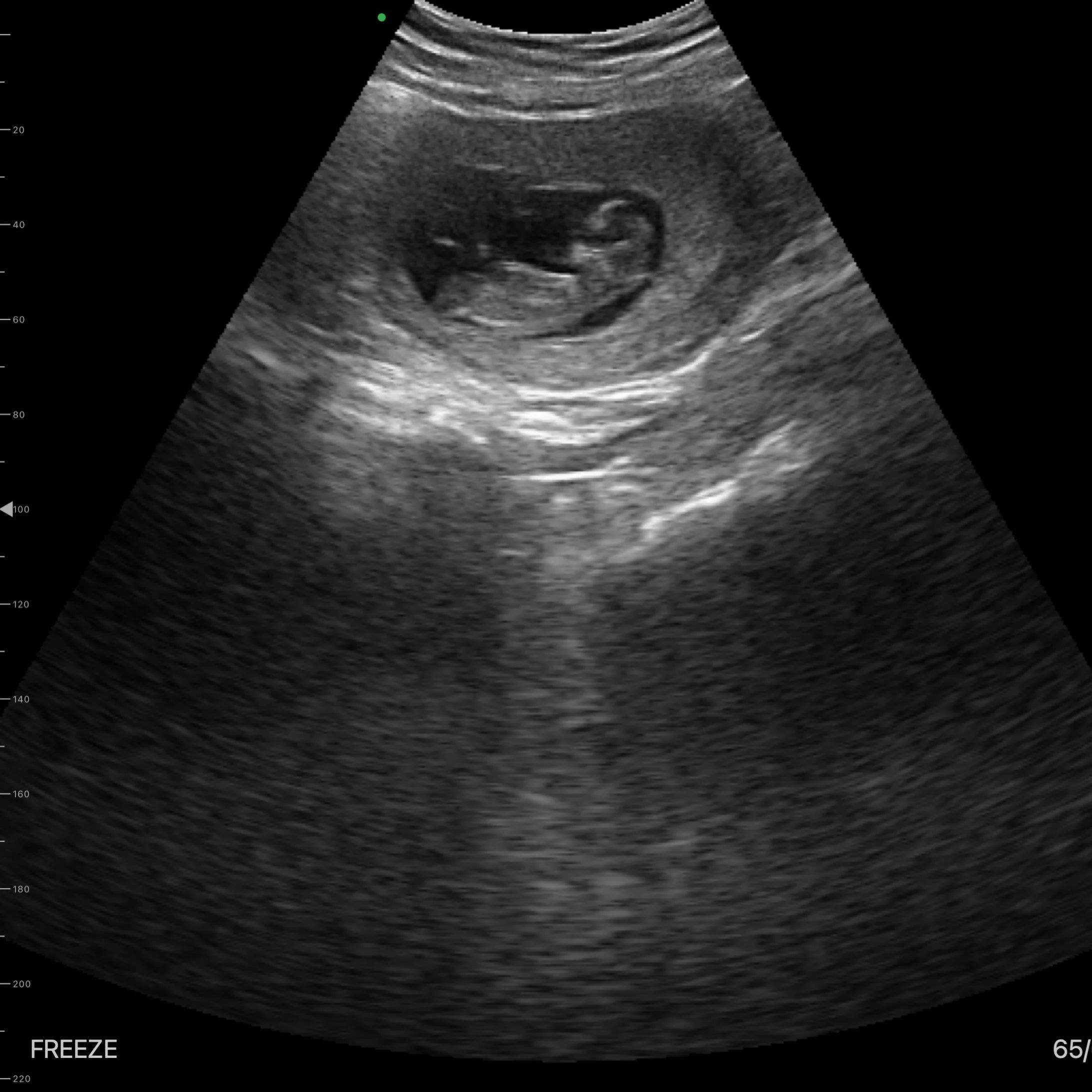 Today was a little different.

I was able to offer a reassurance bedside ultrasound for a beautiful mum while she waits for her next formal scan.

After an IVF journey and previous pregnancy loss, those weeks in between appointments can feel incredib