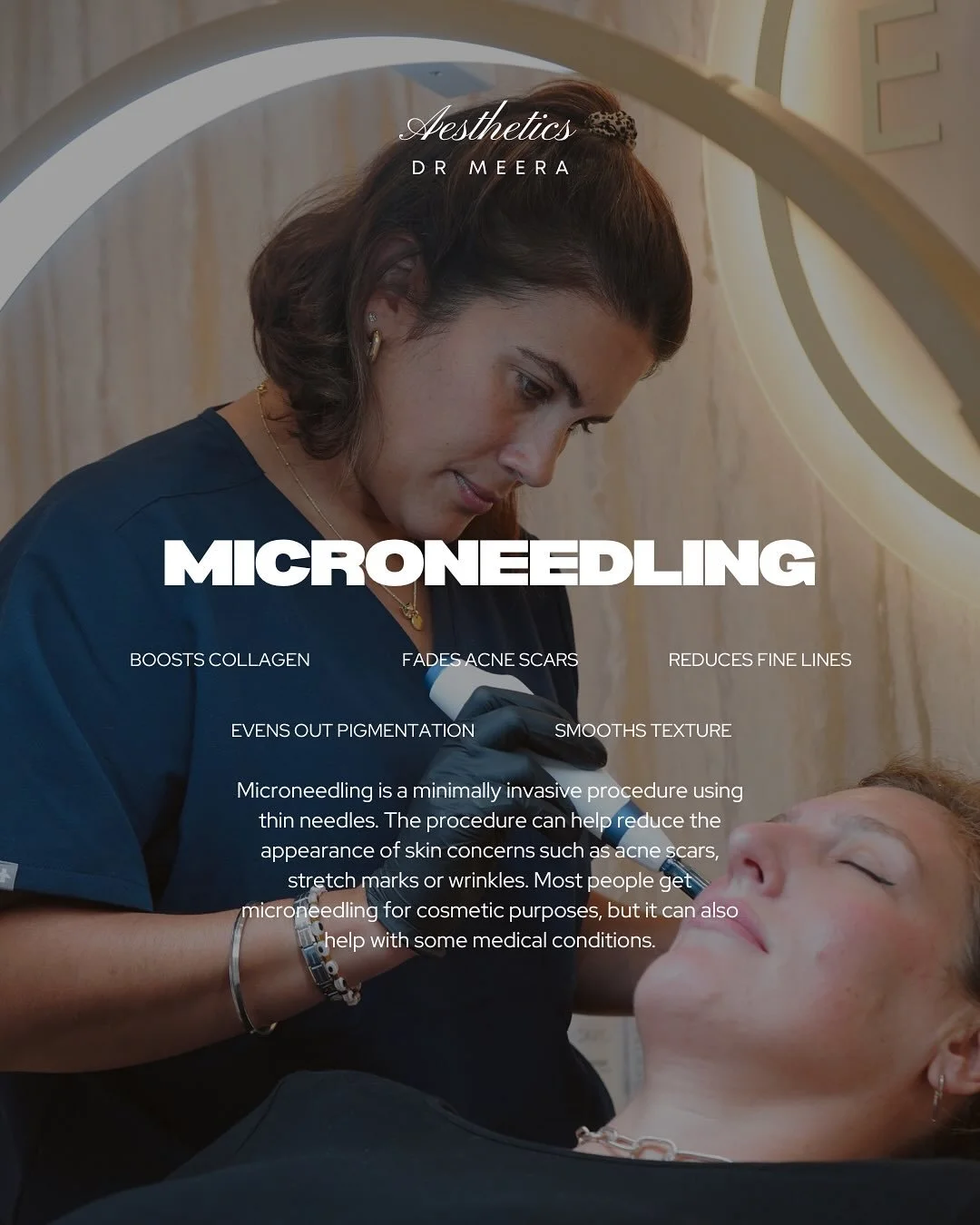 NEW TREATMENT ADDED 💕 

Microneedling is one of the most effective, clinically proven ways to stimulate collagen and refine skin texture.
At Dr. Meera Aesthetics, every treatment is designed and performed with medical precision to ensure optimal res