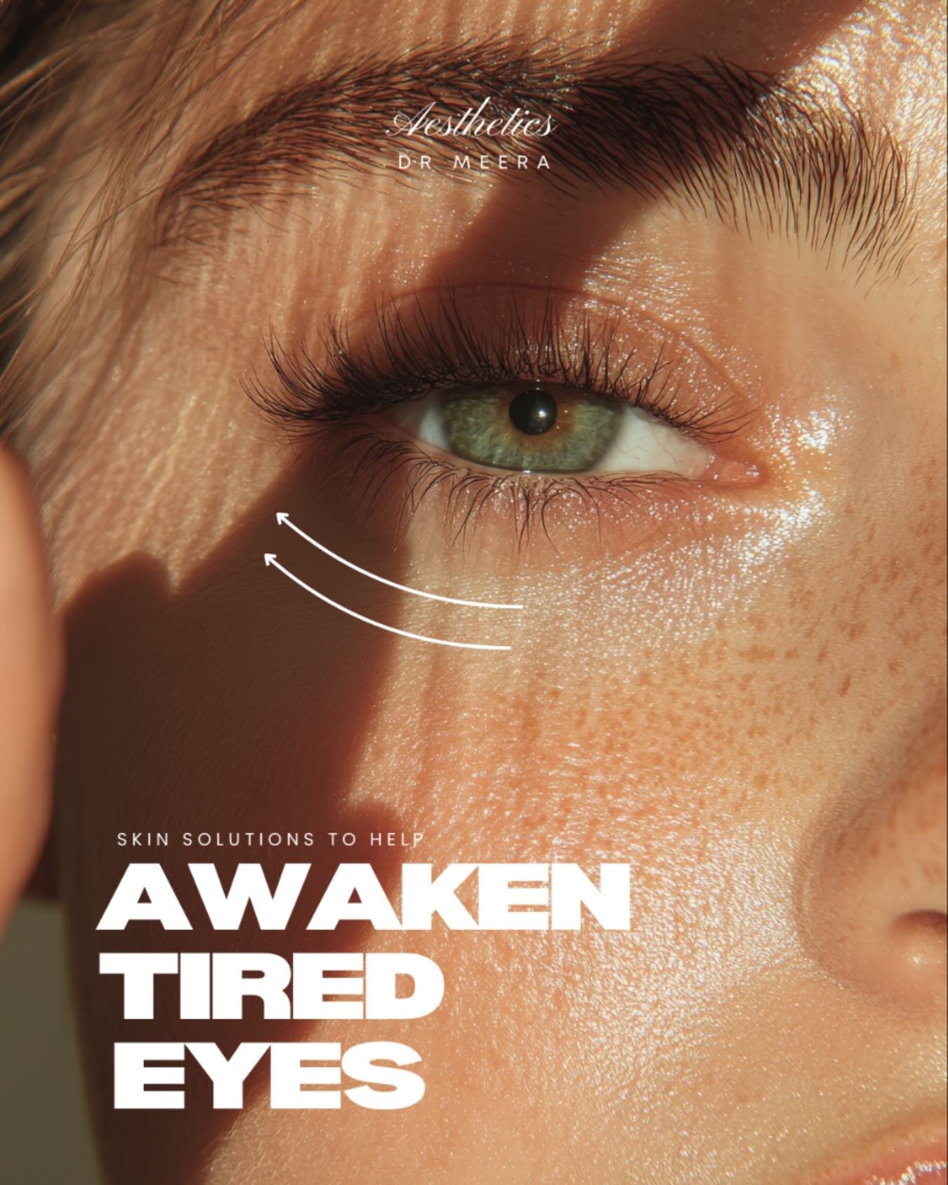 Late nights, long days, and too much screen time your eyes deserve a little TLC! 

From under-eye fillers to brightening treatments and polynucleotides there are gentle, effective ways to refresh and awaken tired eyes.

Say goodbye to dark circles an