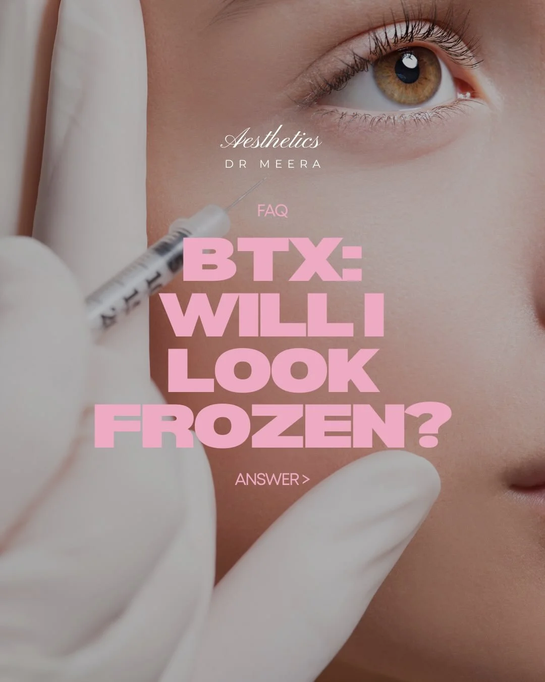 &ldquo;Will I look frozen after Botox?&rdquo; It&rsquo;s the question everyone asks and the answer is no when your treatment is delivered safely and precisely by a medical doctor (unless that&rsquo;s the look you&rsquo;re after) At Dr Meera Aesthetic