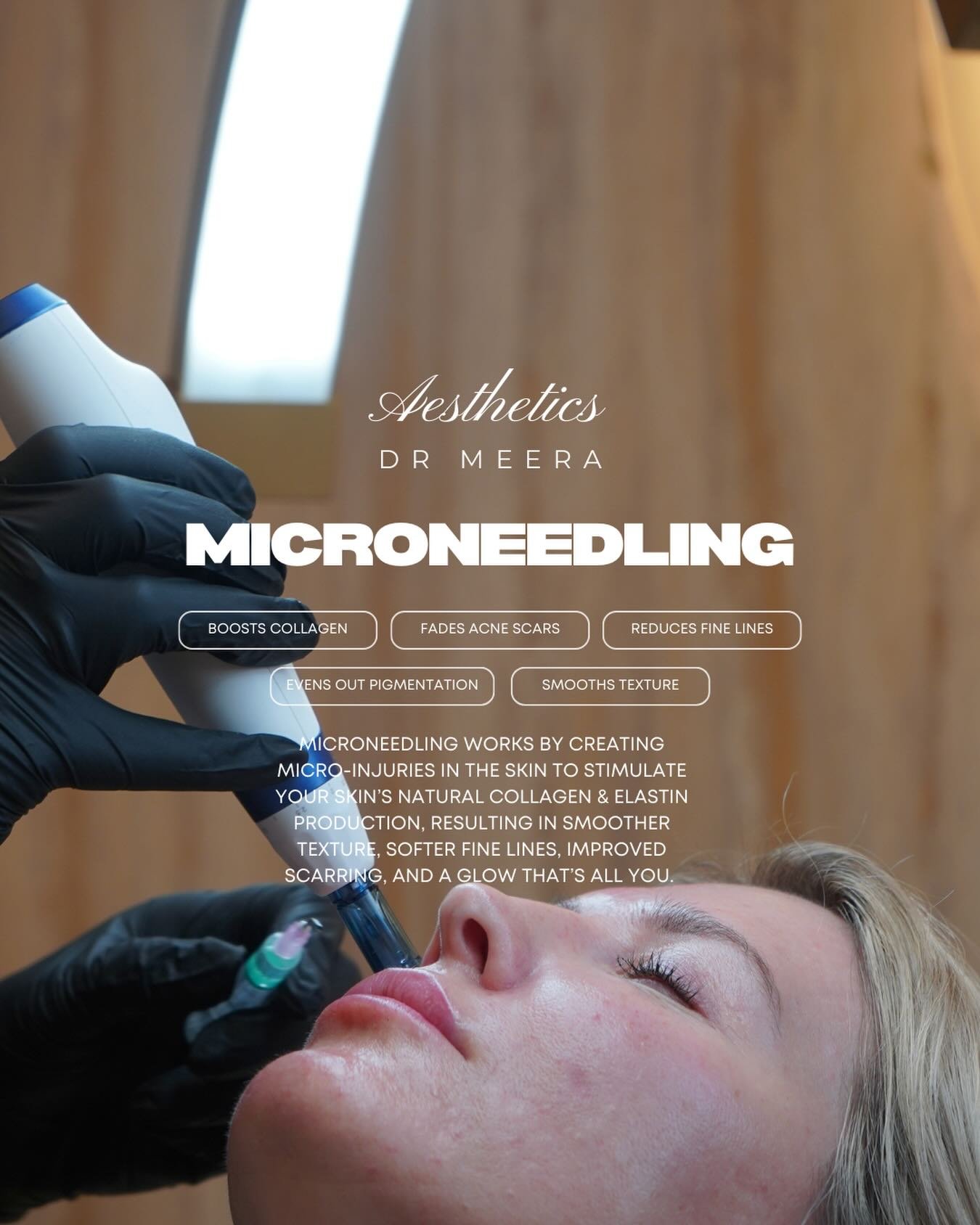MICRONEEDLING: THE SKIN RESET YOU&rsquo;VE BEEN WAITING FOR ✨

Think smoother texture.

Think tighter pores.

Think radiant, refreshed skin naturally.

Microneedling boosts collagen, improves glow, and helps your skincare work smarter, not harder.

M