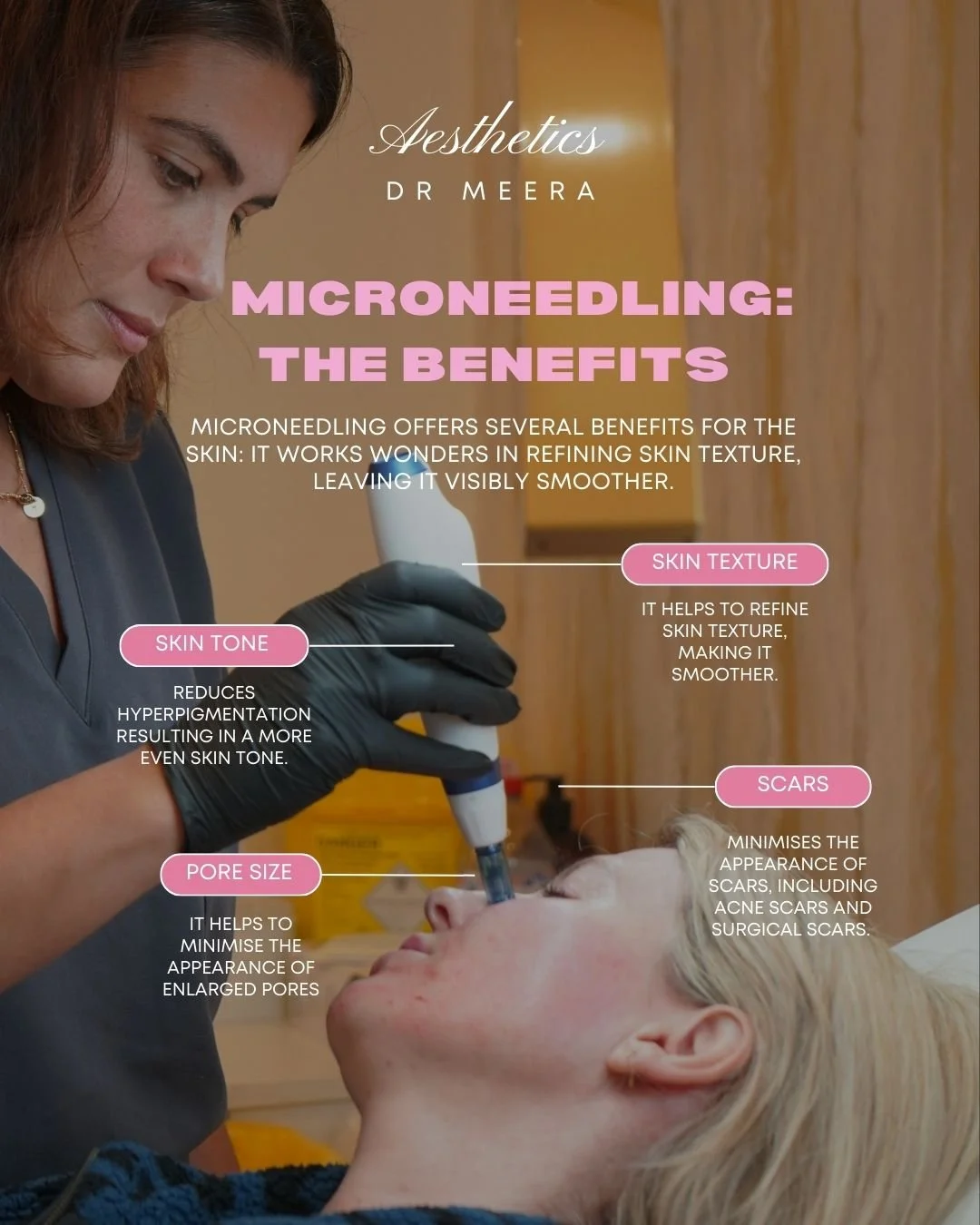 Microneedling offers several benefits for the skin. It works wonders in refining your skin texture, leaving it visibly smoother. It helps target some of our main skin concerns like texture, tone, scars, pore size and so much more! 

📲 DM to enquire 