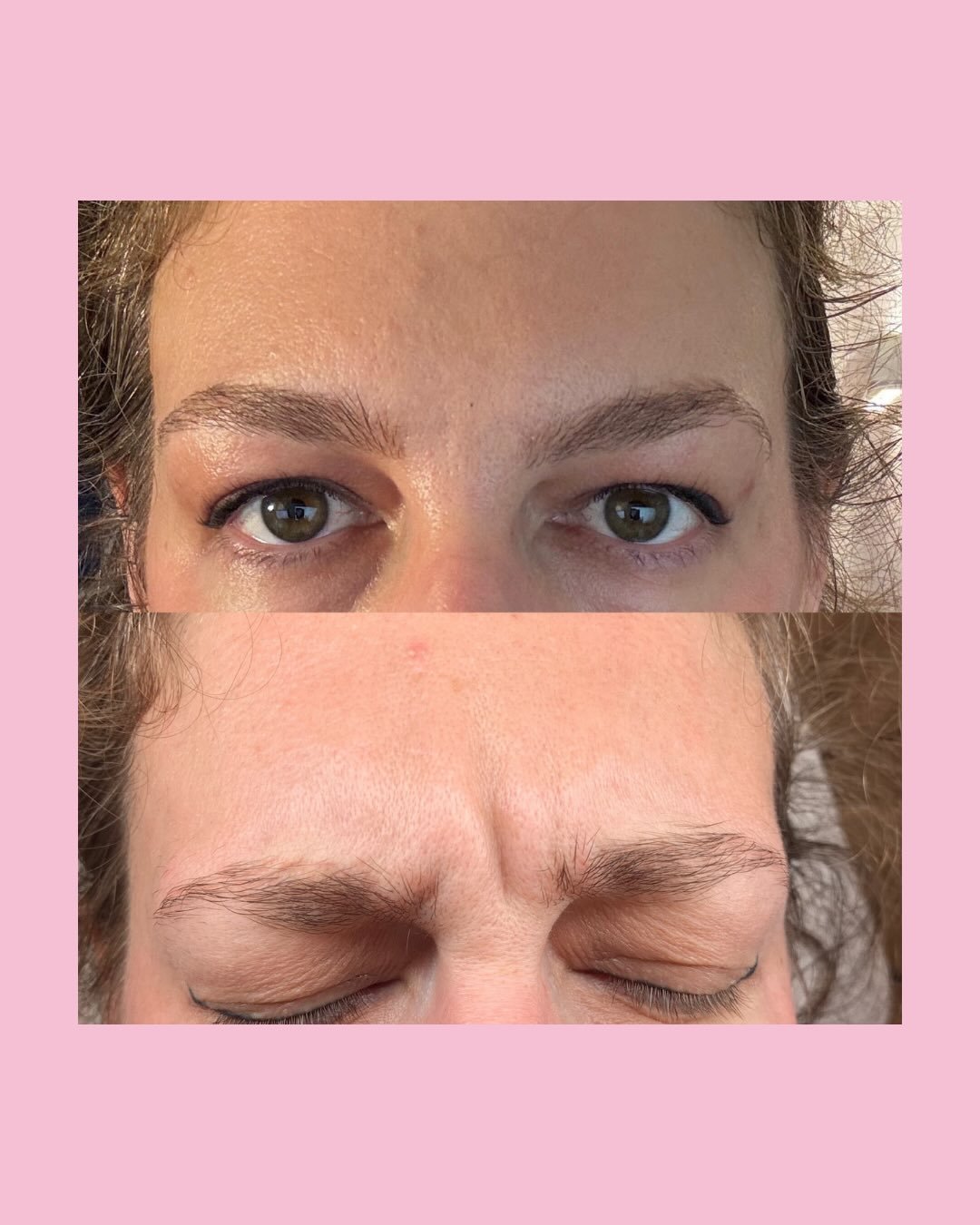 Don&rsquo;t just take our word for it! Real patients, real results, real feedback. We love to hear from you about your experience in clinic with Dr Meera. If you haven&rsquo;t already, please do head to Fresha and tell us about your experience or sen