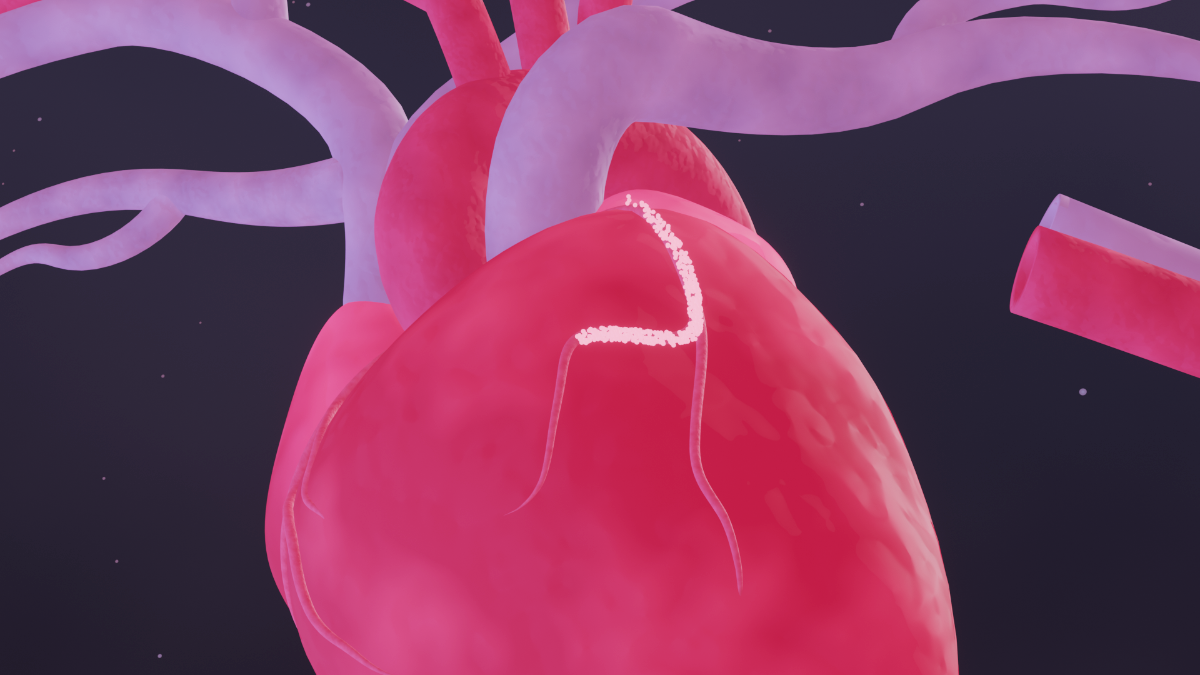 Claroswift Medical Scene with heart and blood flow