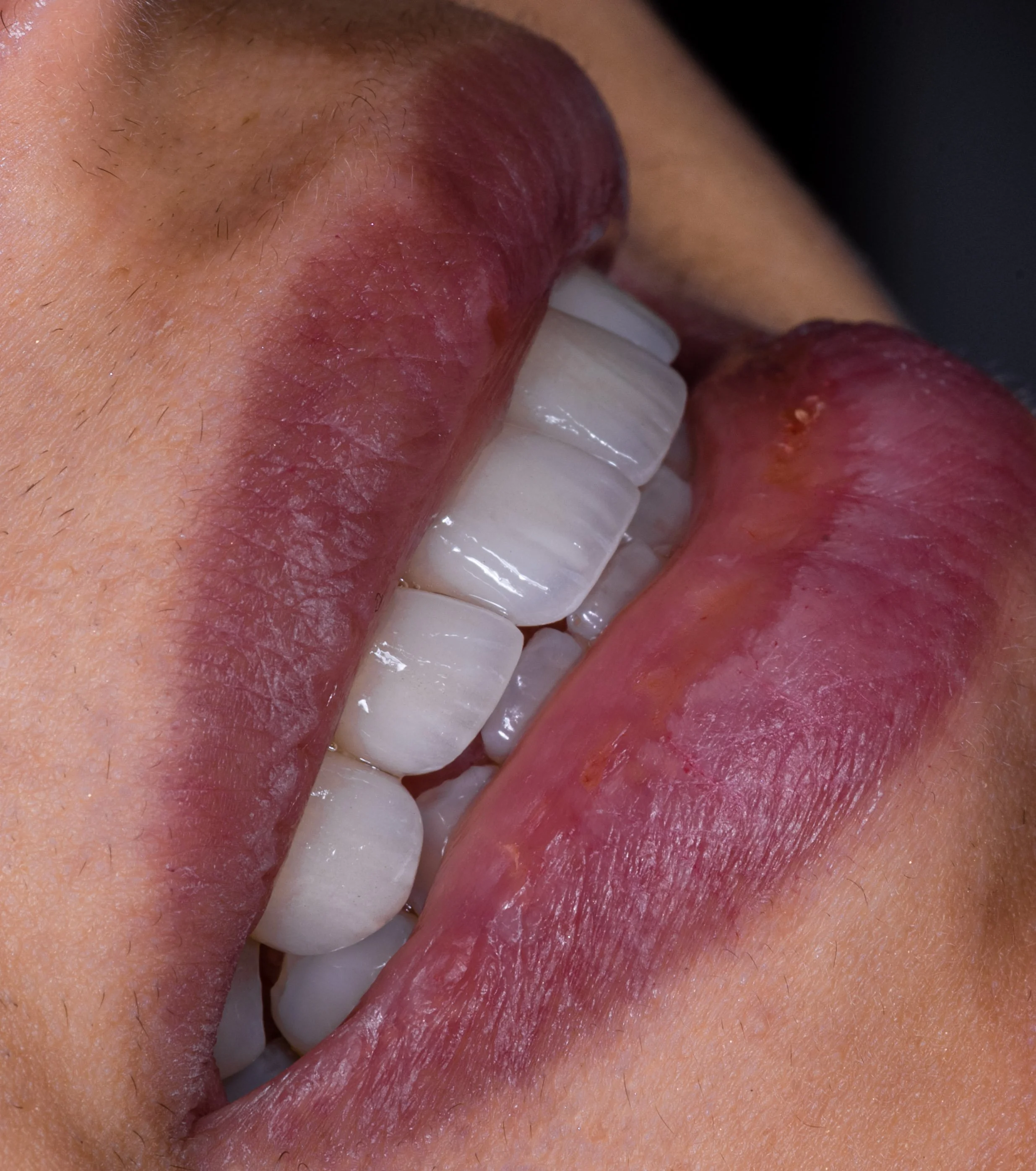 Close-up of a person's mouth with lips slightly parted, showing their teeth and tongue.