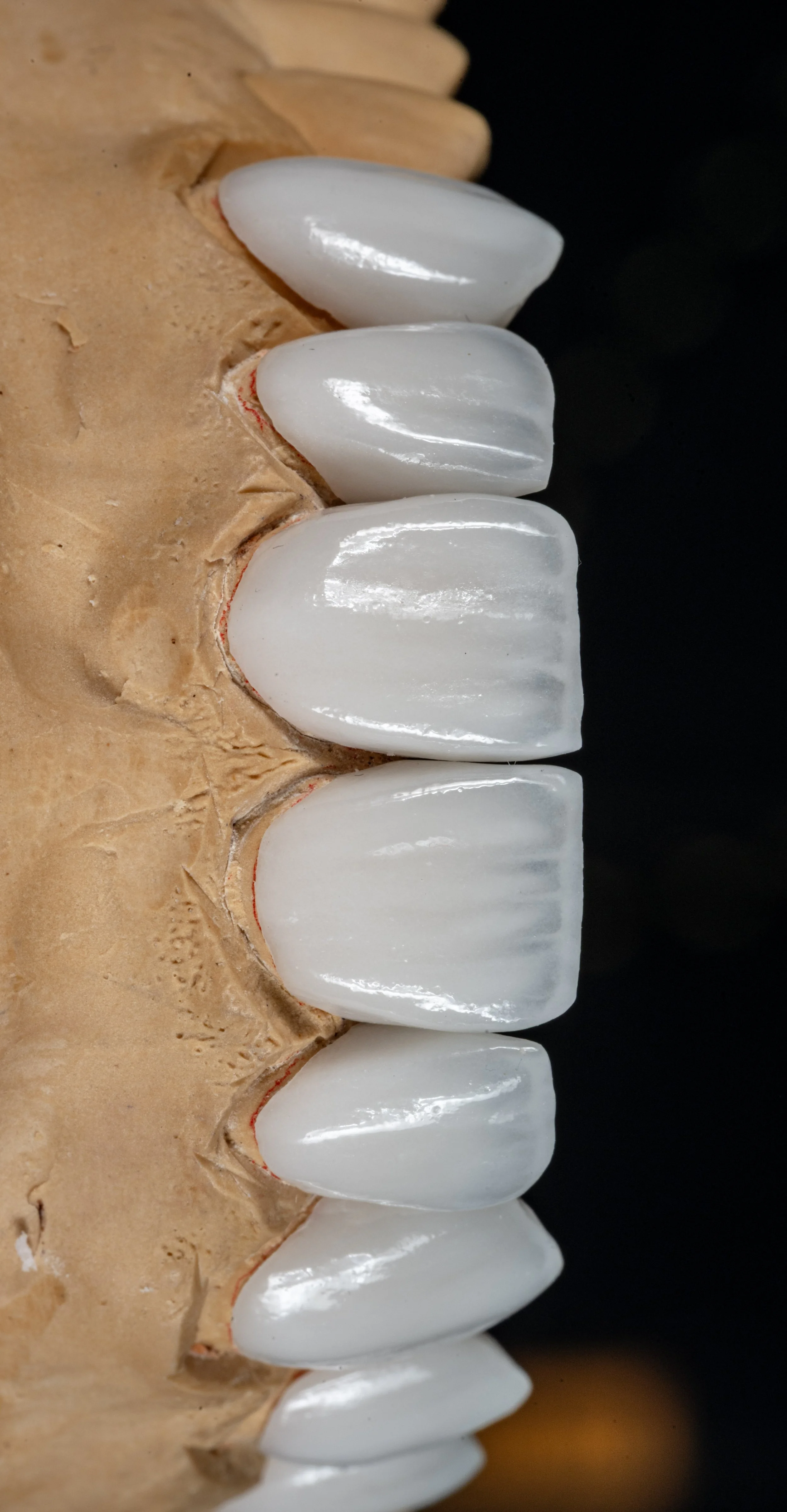 Close-up of a model of human upper teeth with some gums visible, showing the front teeth in a row from left to right.