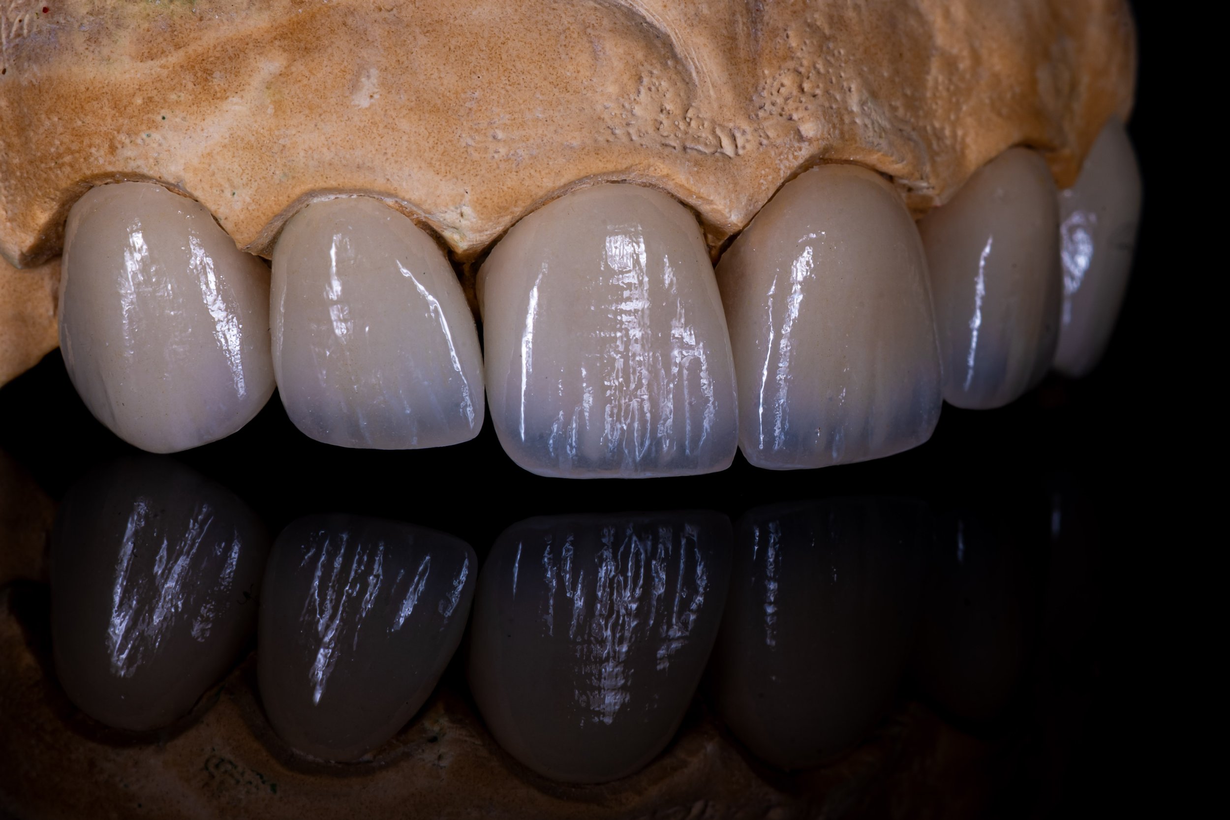 Close-up of dental prosthetic teeth on a dental model with reflection underneath, showing white ceramic crowns.