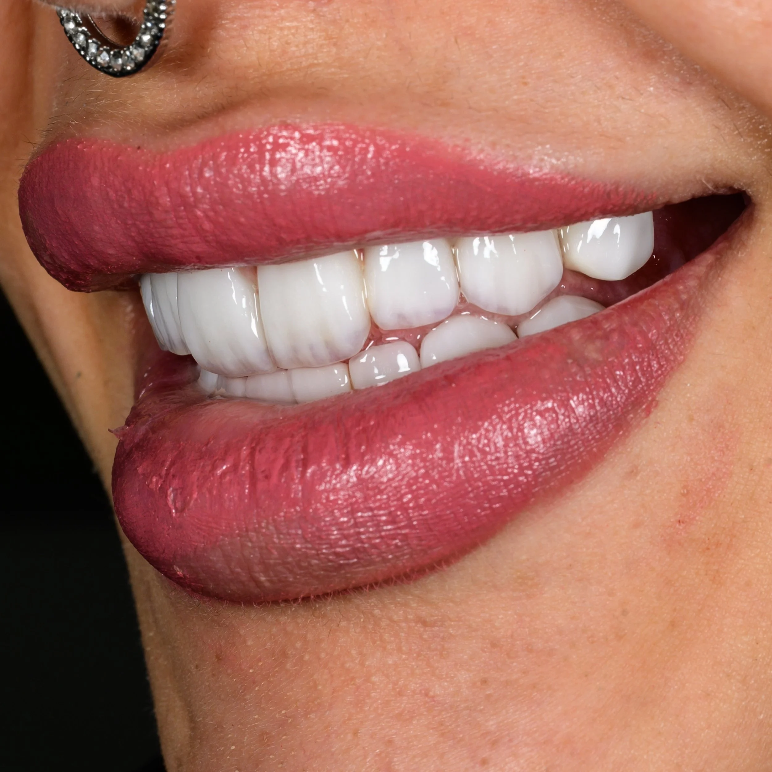Close-up of a person's smiling mouth with pink lipstick, showing teeth and lipstick swiped on the upper lip, and a black background.