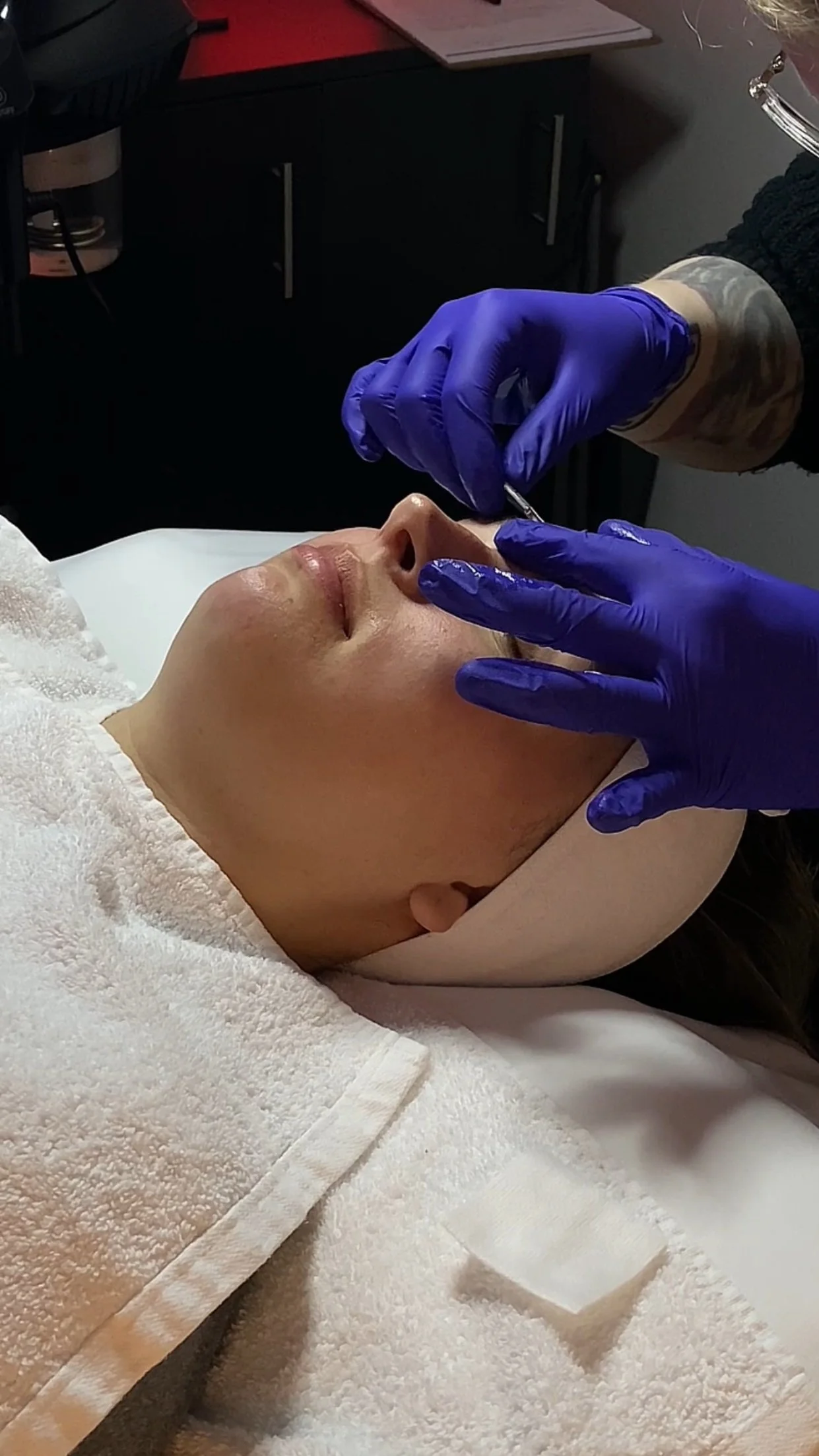 A woman receiving a cosmetic injection in the nose area from a professional wearing purple gloves, lying on a bed with a towel around her head.