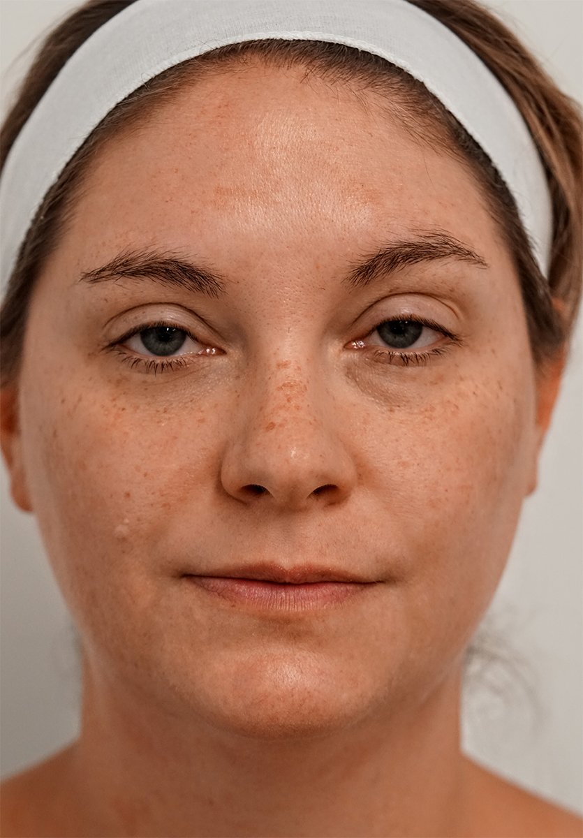 Close-up of a person's face with a white headband, showing freckles and a neutral expression.