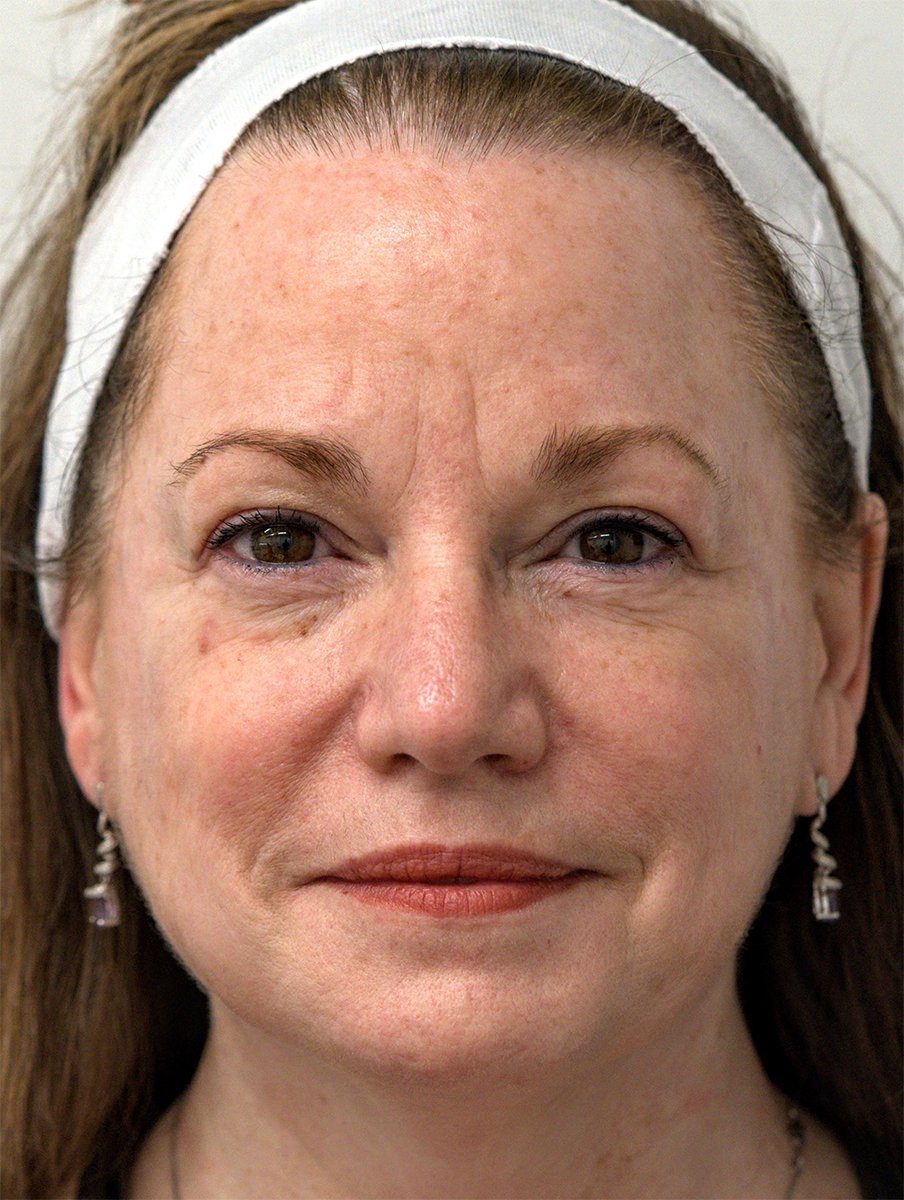 A close-up portrait of a middle-aged woman wearing a white headband and earrings, looking directly at the camera.
